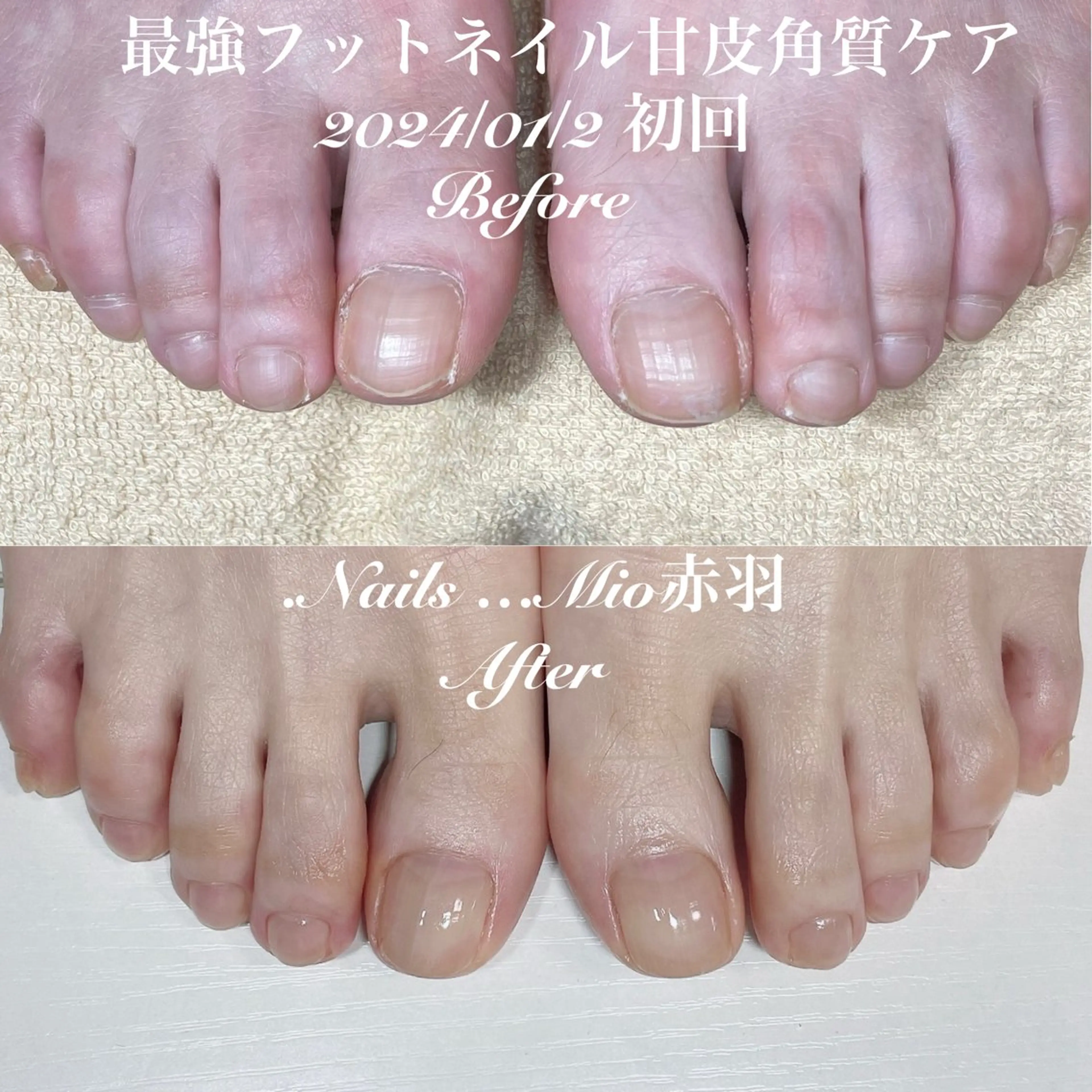 ネイル フットネイル フットネイル .Nails Mio 赤羽西ネイルサロンのネイルデザイン