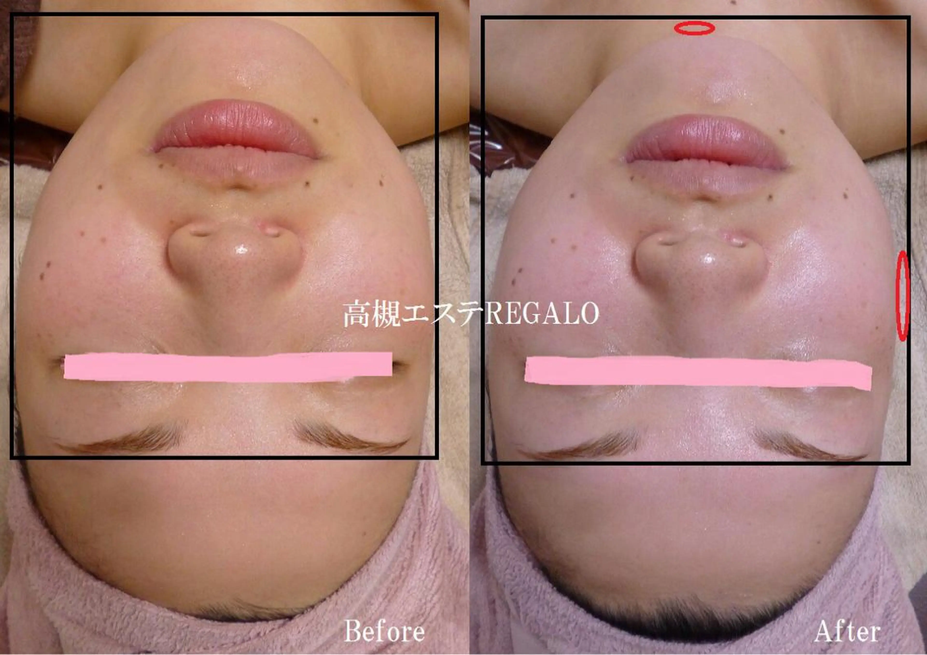 エステ 矢野 さやかのエステ・リラクイメージ