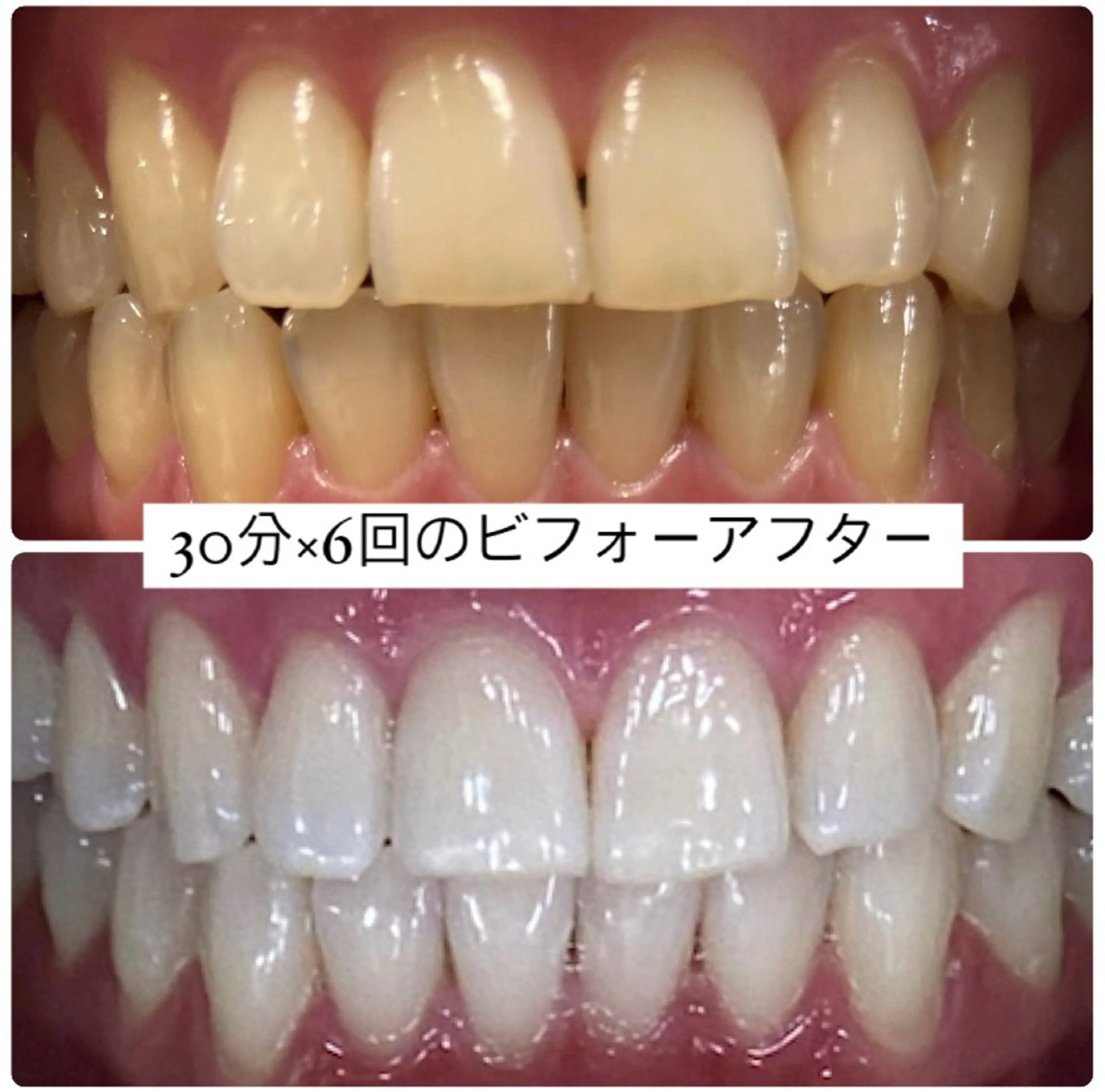 ホワイトニングルーム 横浜店のその他イメージ