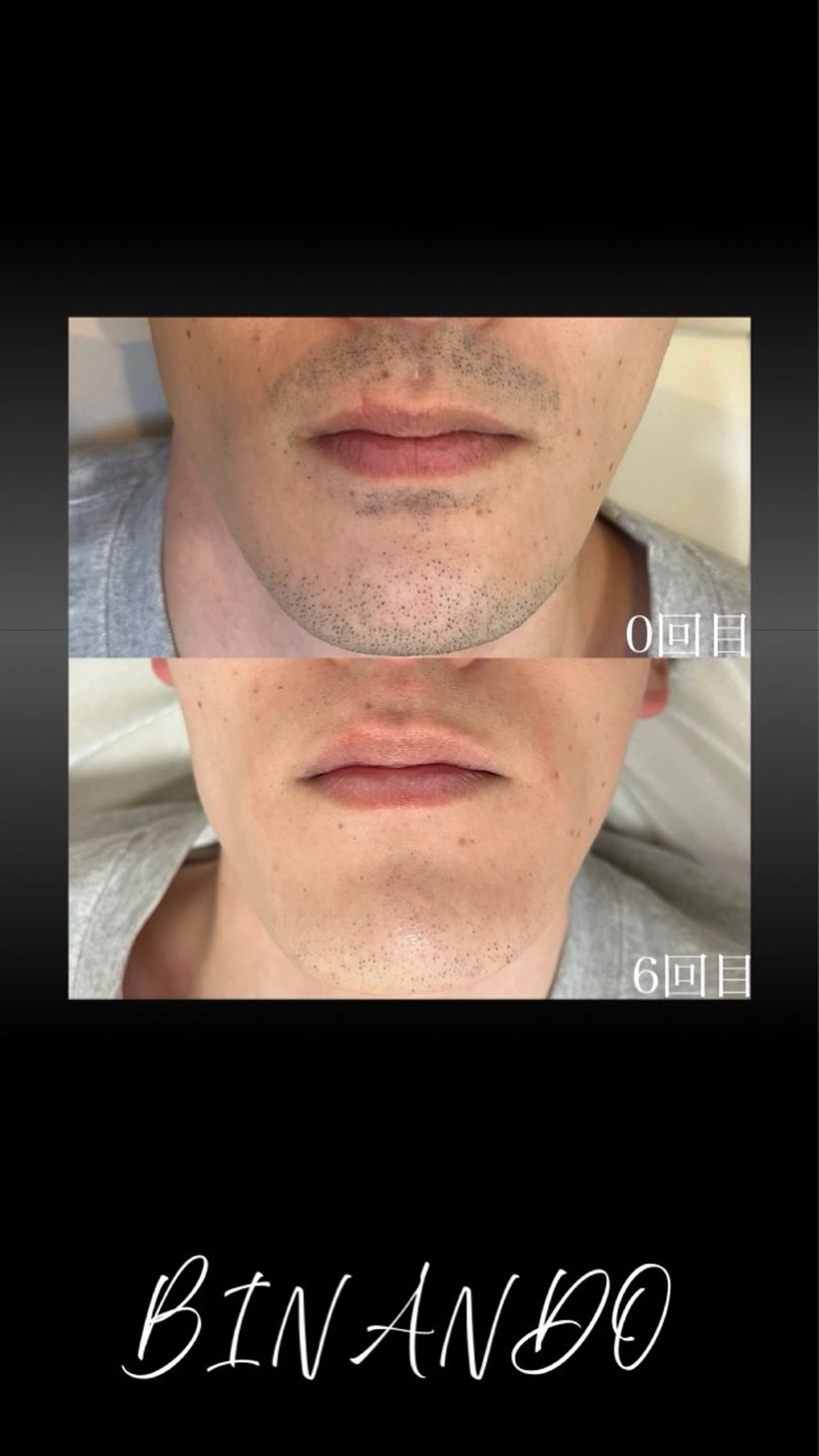 メンズ 脱毛 BINANDO 桑原の眉毛・アイブロウイメージ