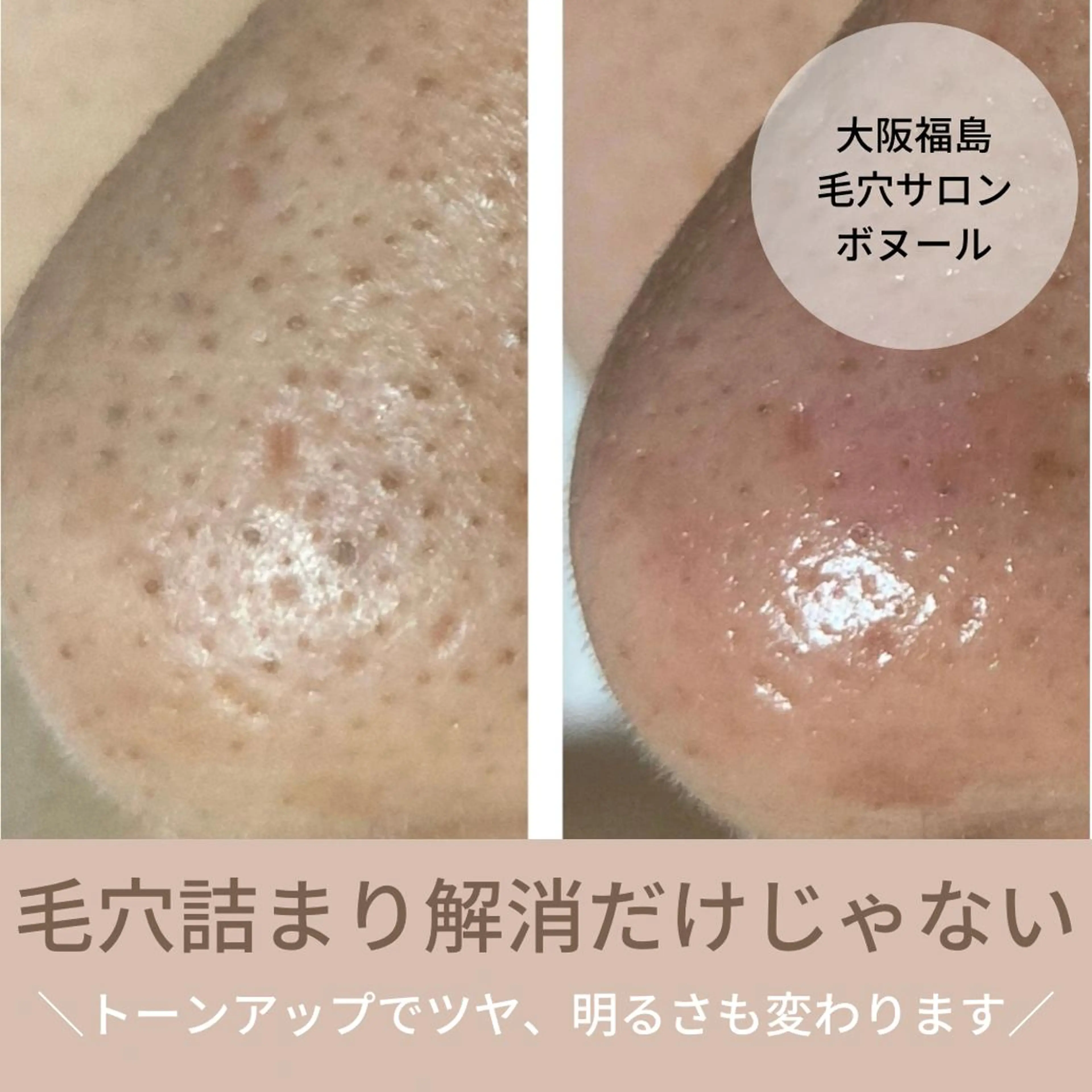 エステ 毛穴ケア・肌質改善 徳川のエステ・リラクイメージ