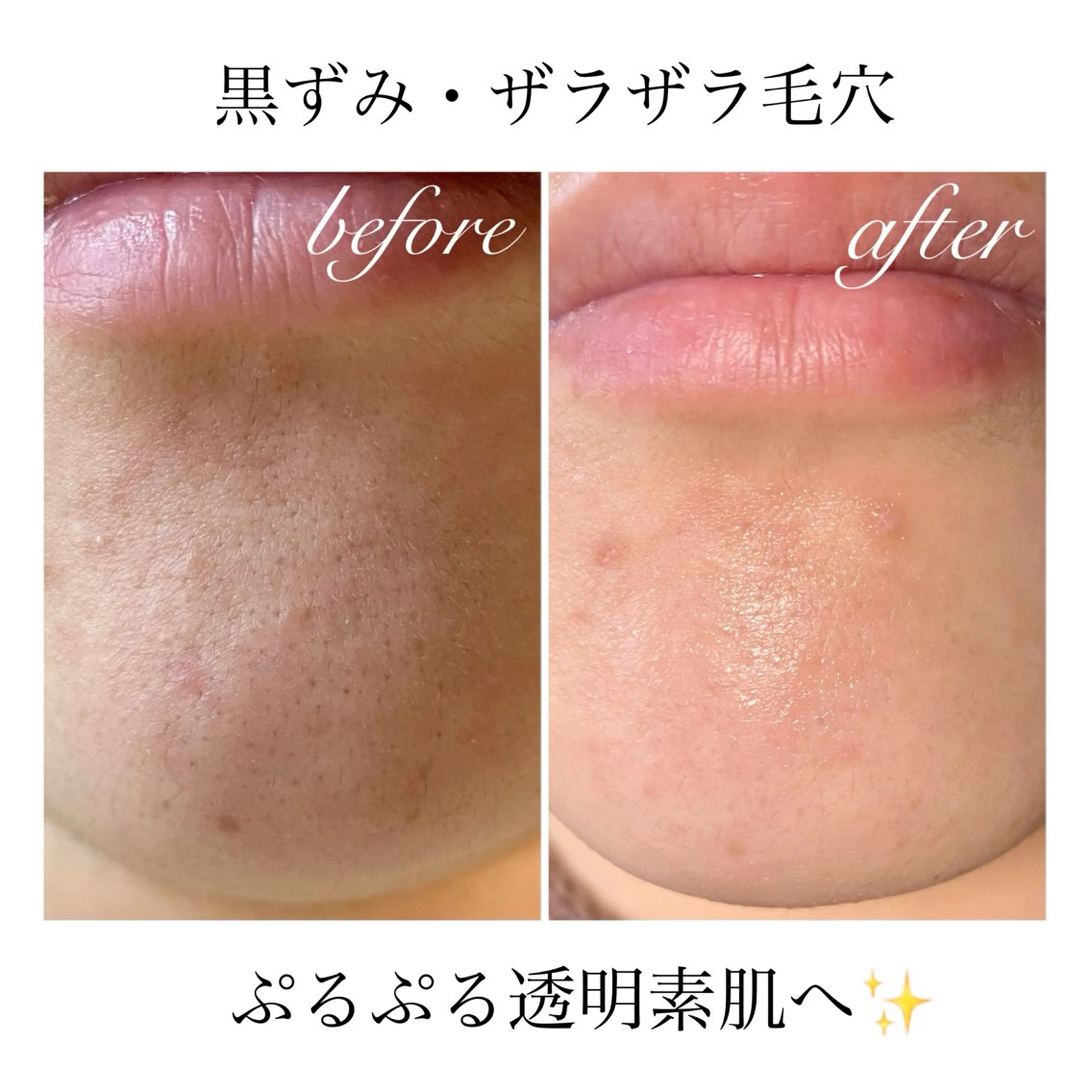 エステ リラク ダイエット・美肌ケア fleurのエステ・リラクイメージ