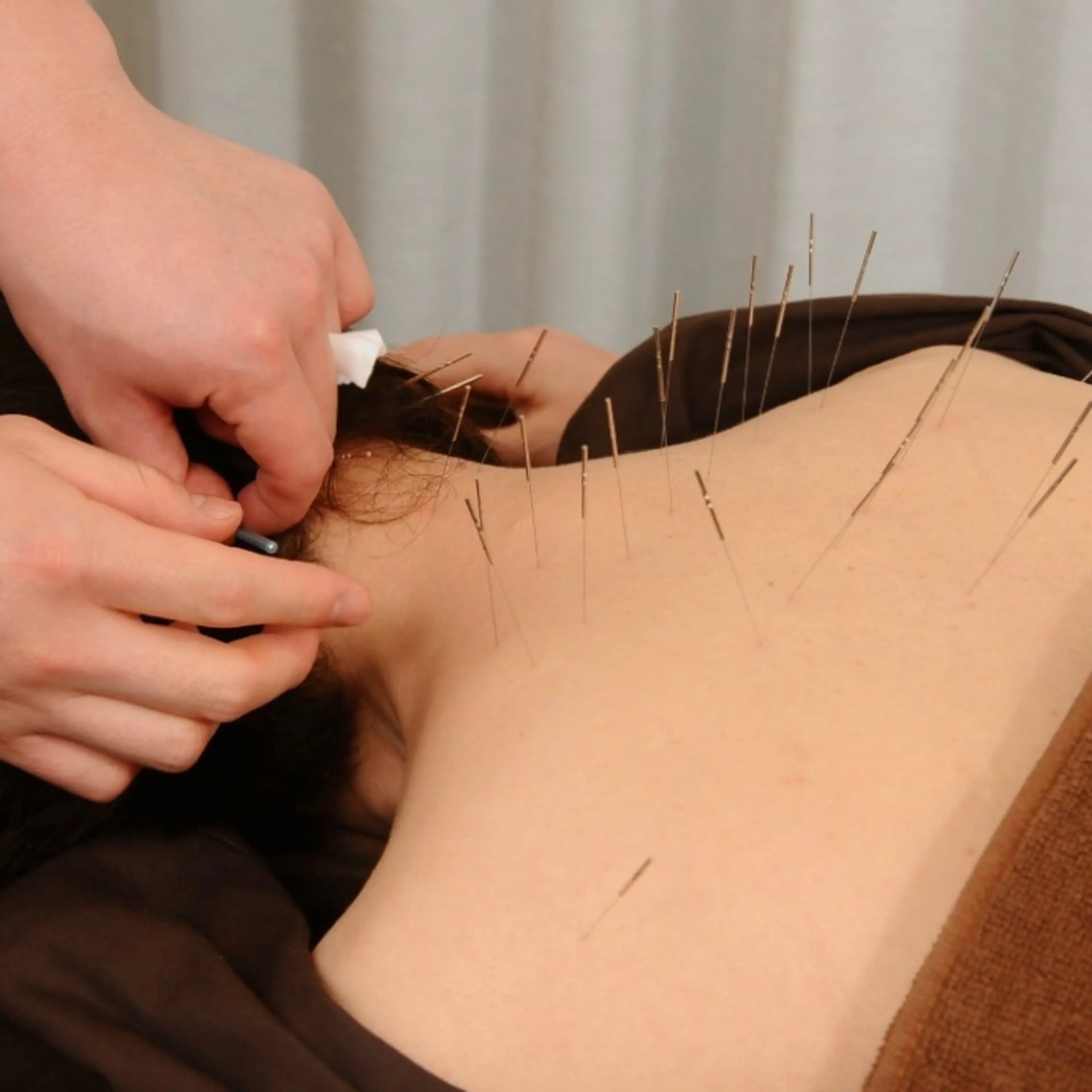 エステ リラク Spring鍼灸院所属・Spring鍼灸院 ✨首肩こり、腰痛に！のその他イメージ