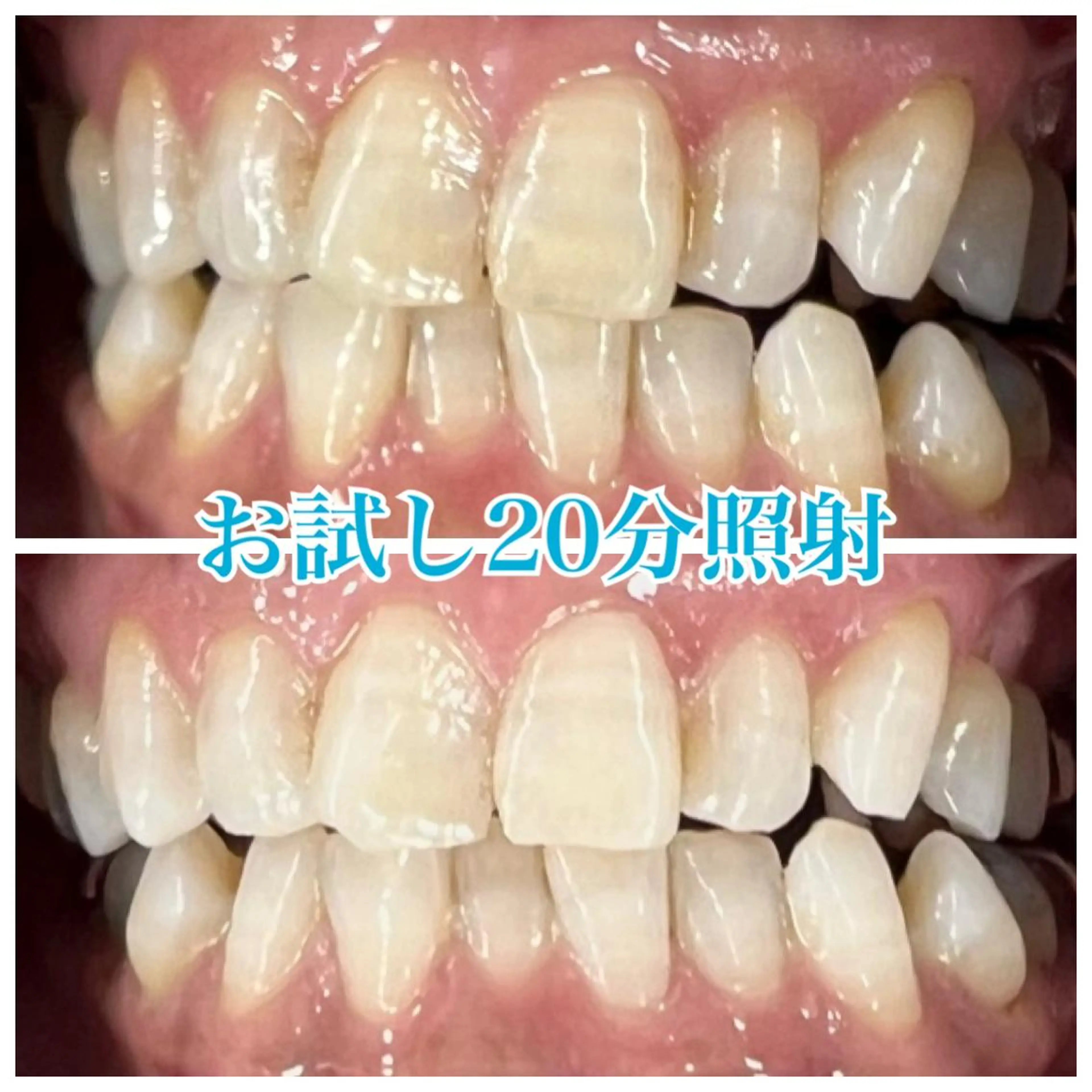 nailsalon   LE'A所属・ホワイトニング🦷 ネイル💅LEAのその他イメージ