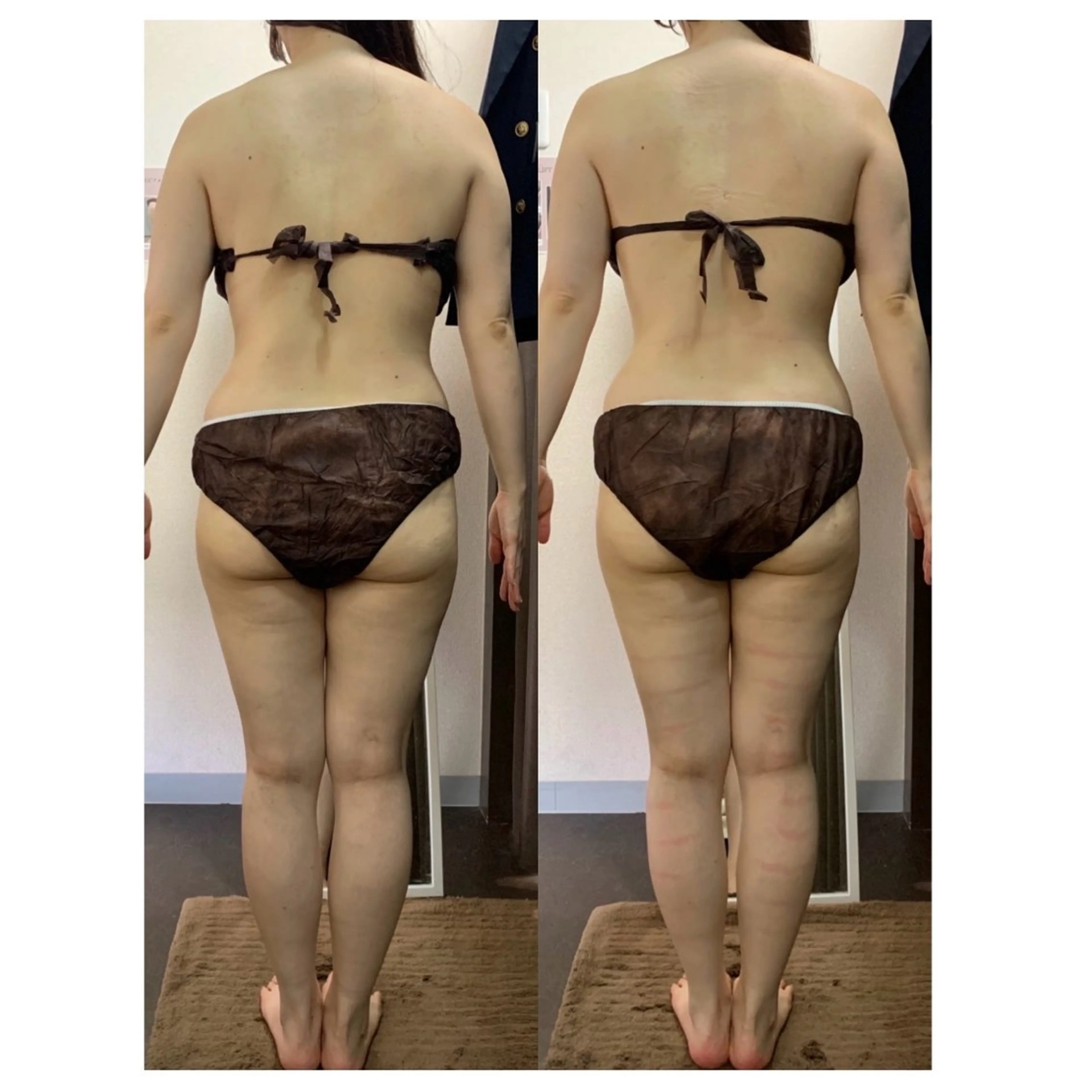 ハイパーナイフ専門店　Salon de COCO所属・Salon de COCOのエステ・リラクイメージ