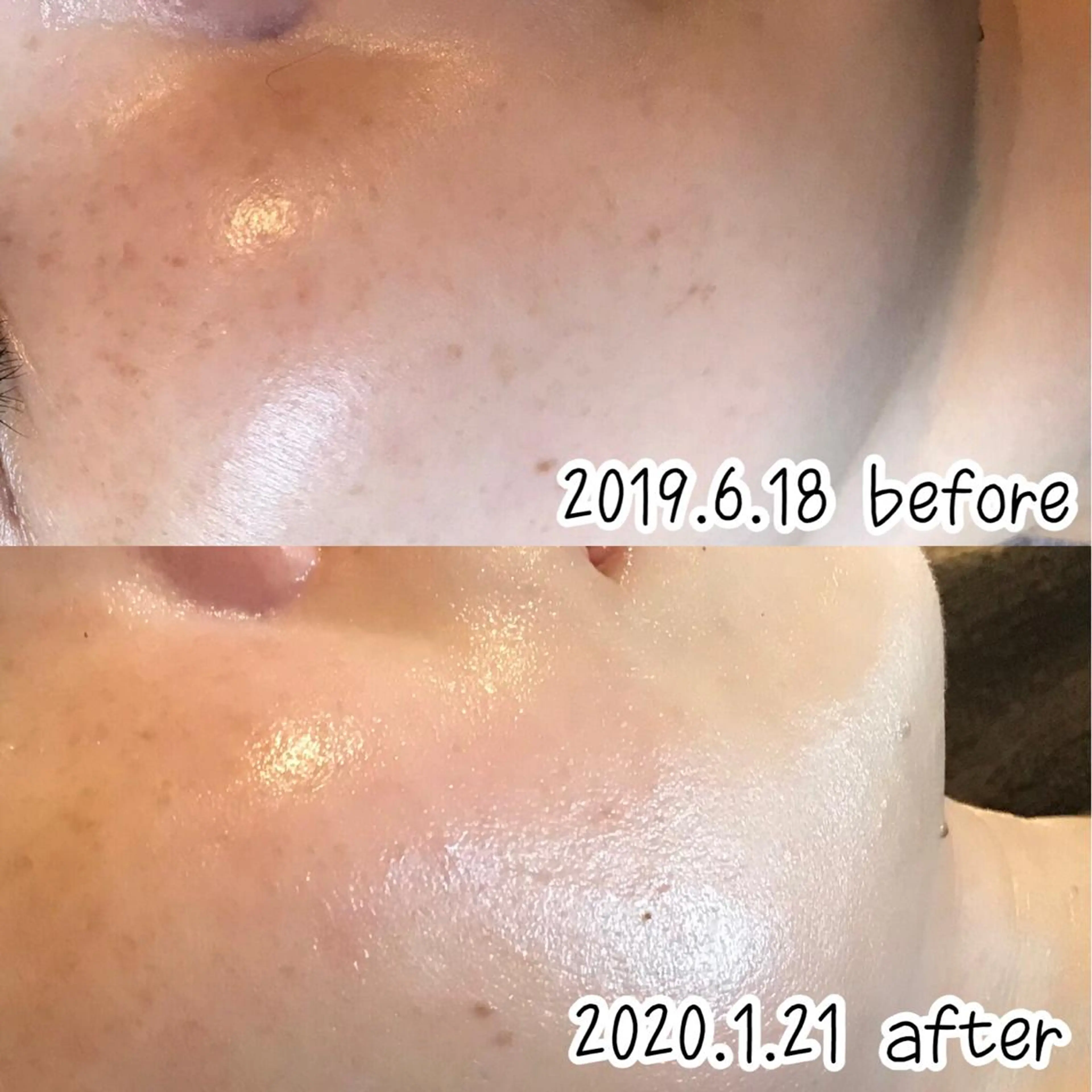 エステ 浜野 恵美のエステ・リラクイメージ