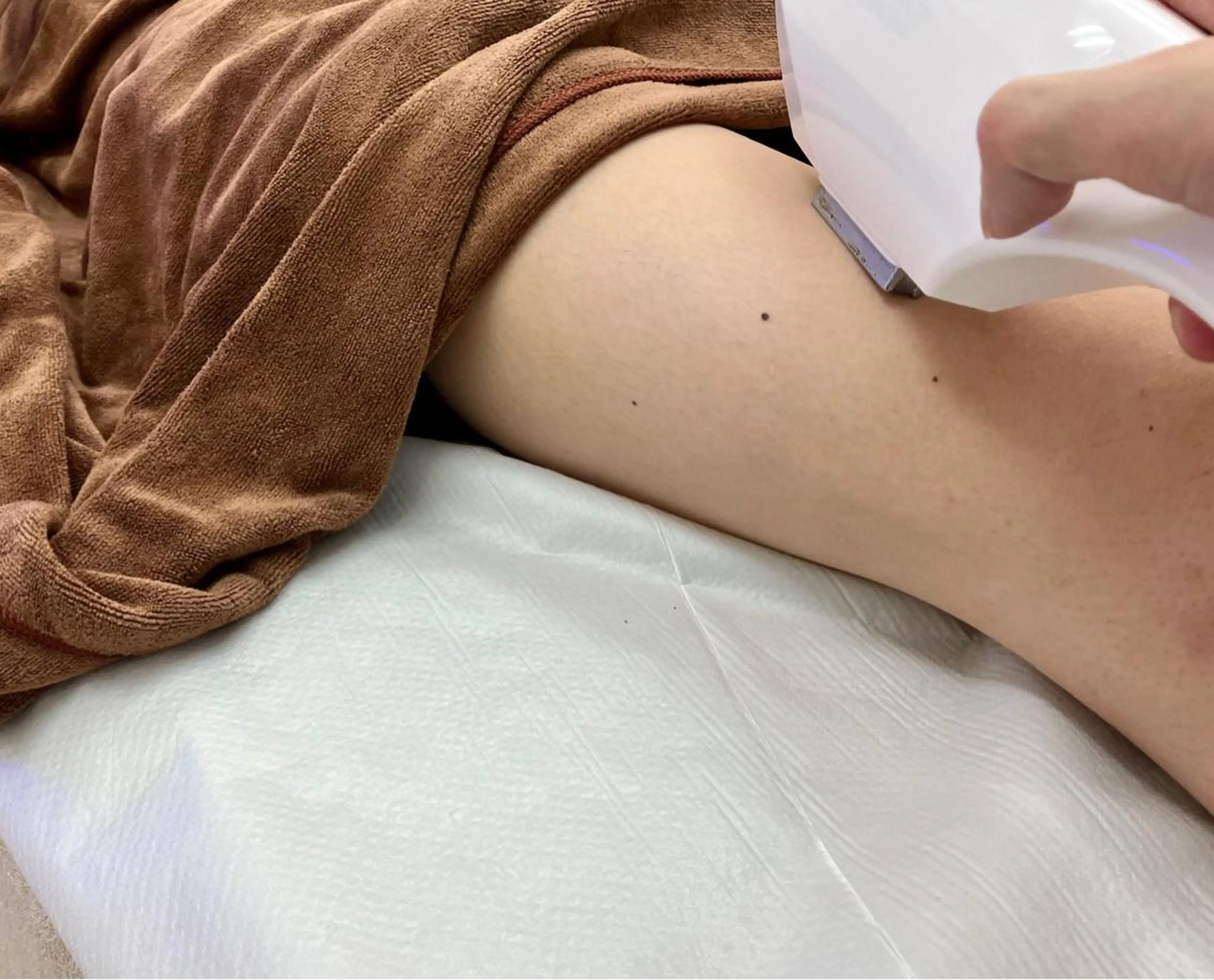 新規　両足全体【ひざ上、ひざ下、足指甲】の写真