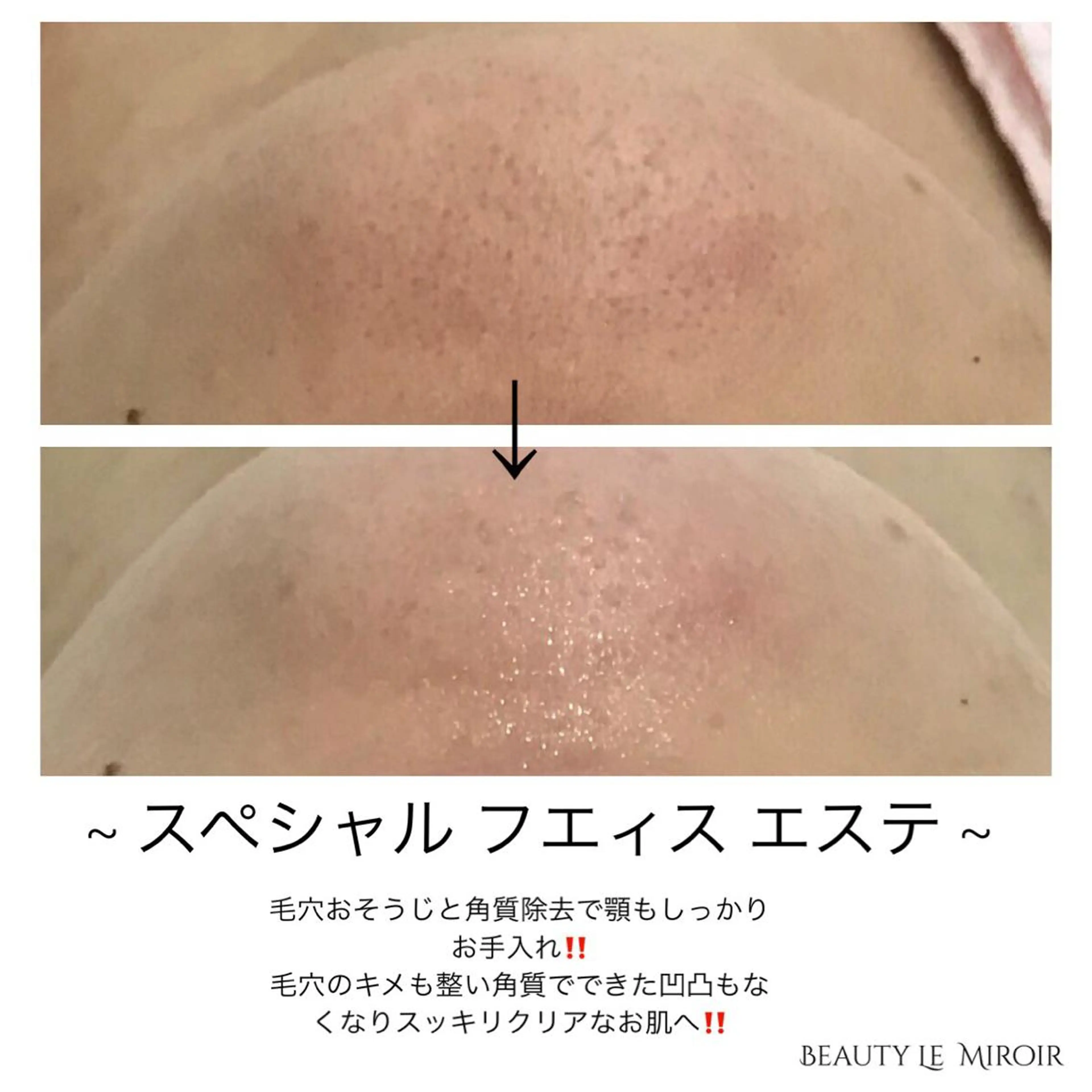 マツエク・マツパ ビューティー ミロワールのエステ・リラクイメージ