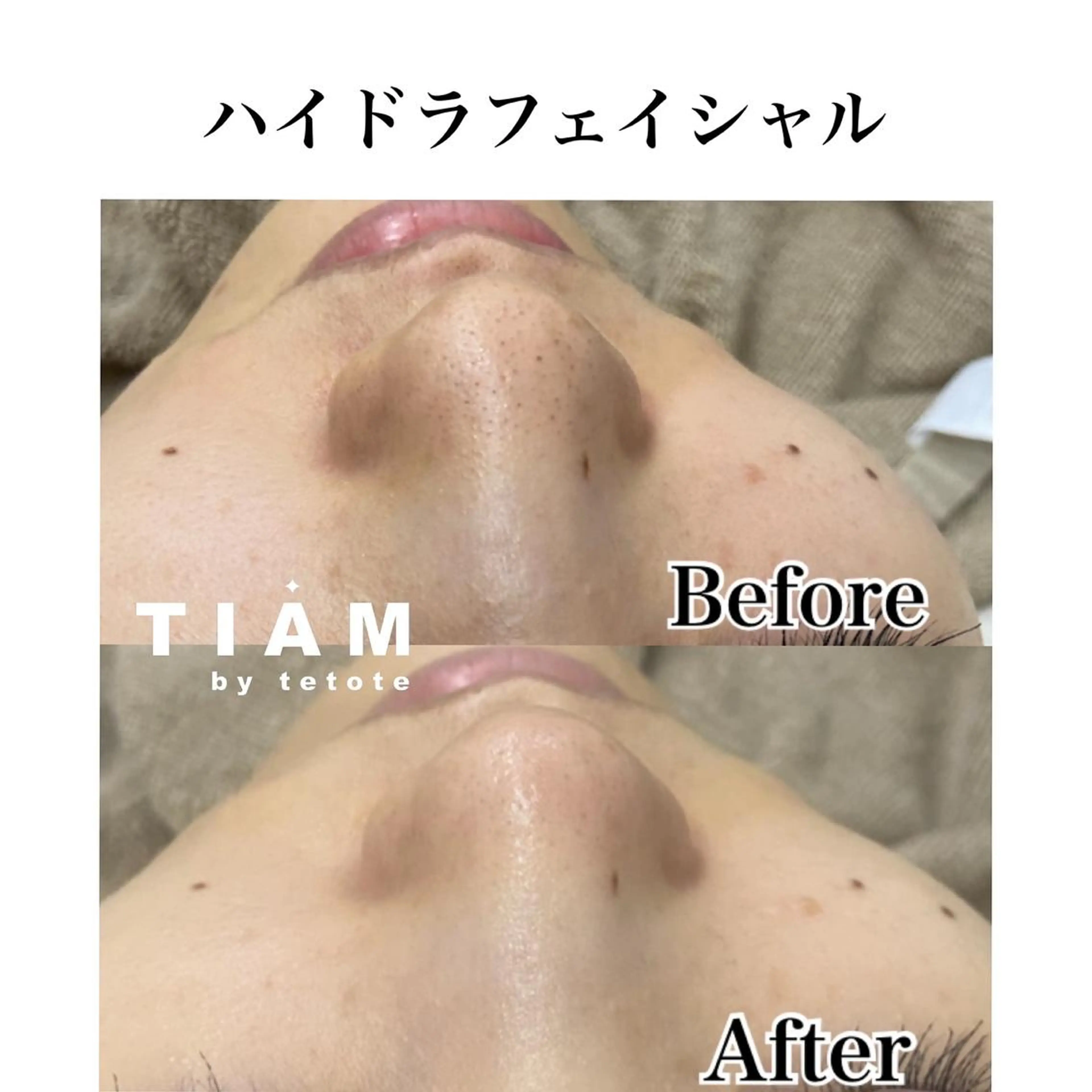 美肌サロンTIAM by tetoteのエステ・リラクイメージ