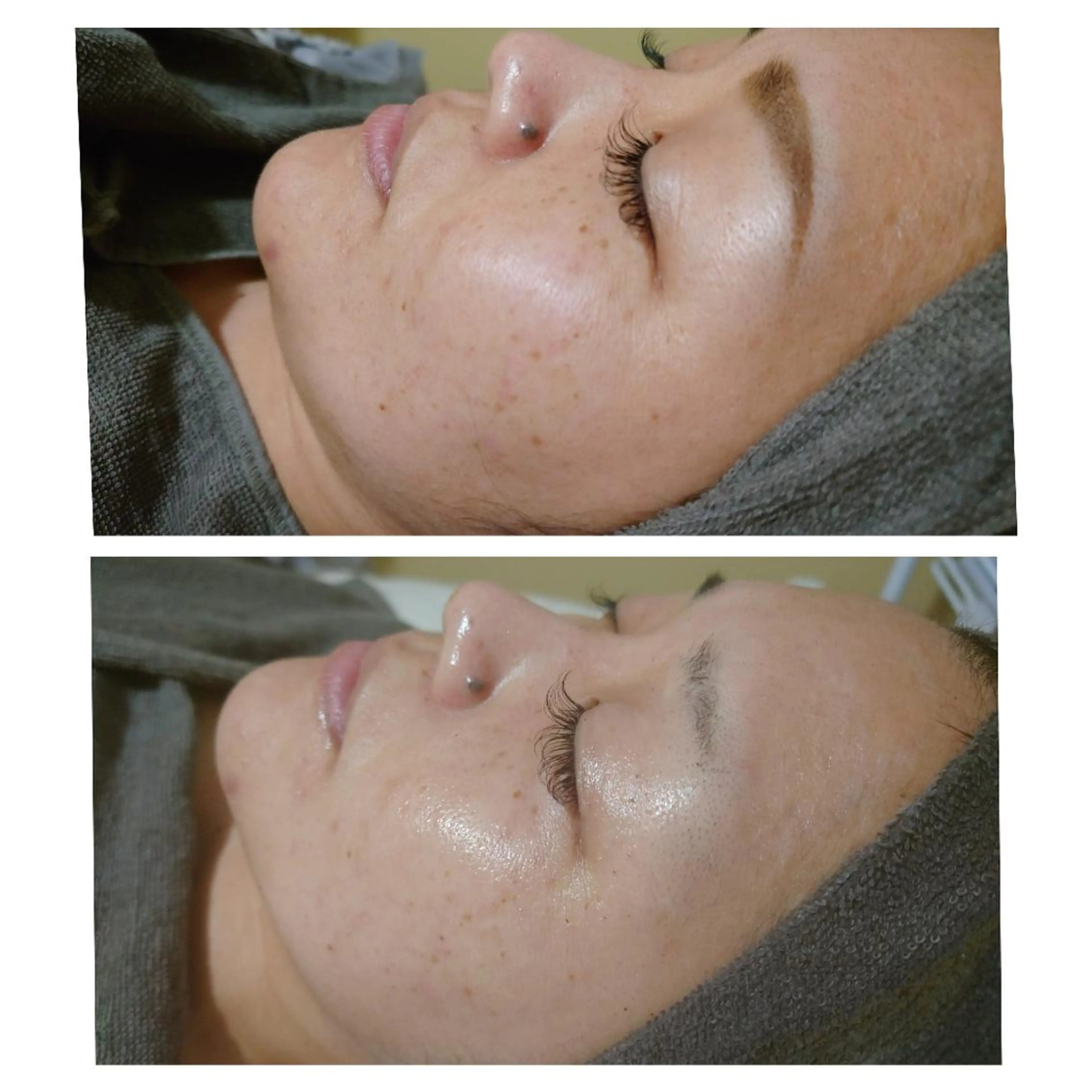 エステ Beauty Salon Luana所属・Luanaまつパ脱毛 ハーブピーリング眉毛のマツエク・マツパデザイン