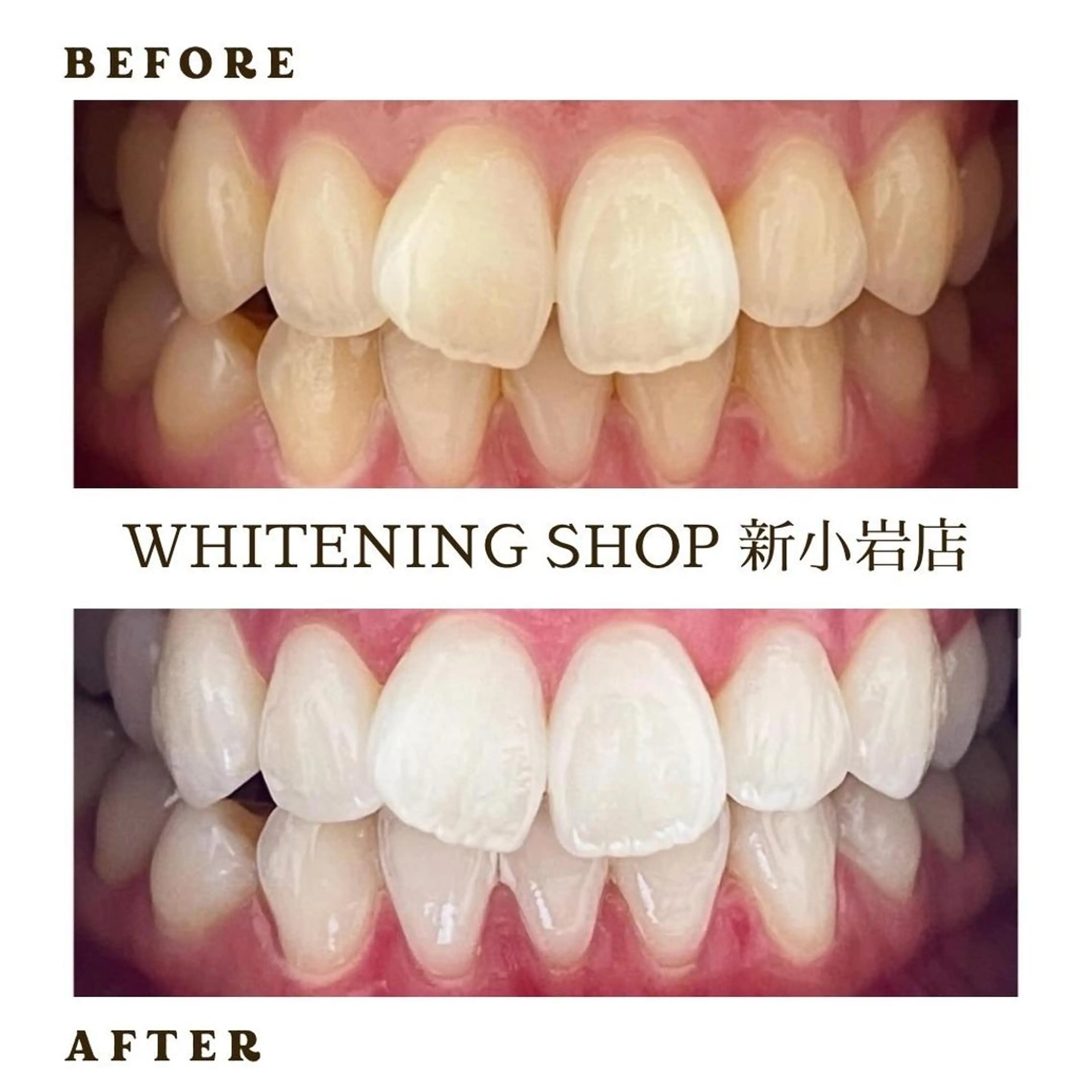 メンズ その他 ホワイトニング ショップ新小岩店のその他イメージ