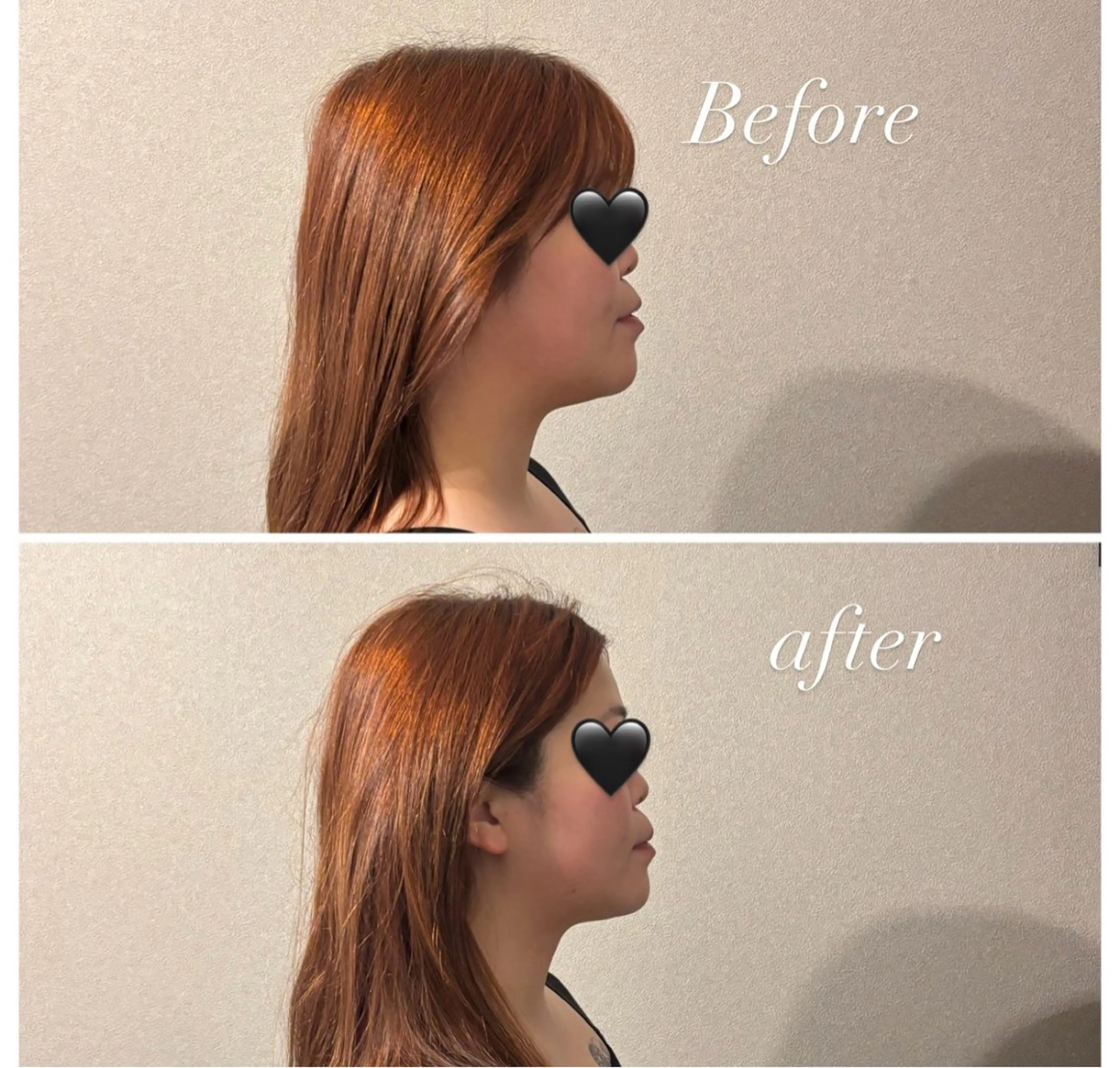 圧倒的たるみ改善 美容鍼エステのエステ・リラクイメージ