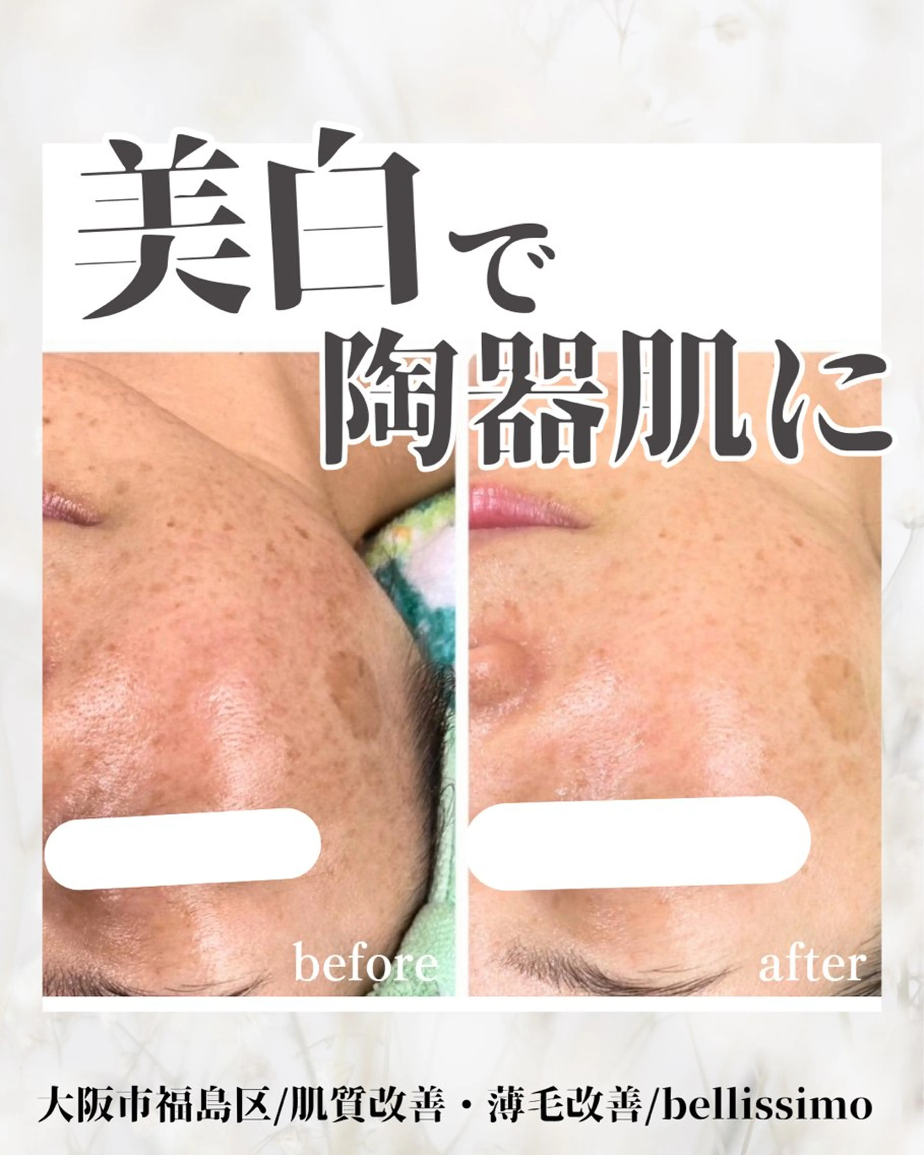 ちひろ　痩身/ハーブ bellissimoのエステ・リラクイメージ