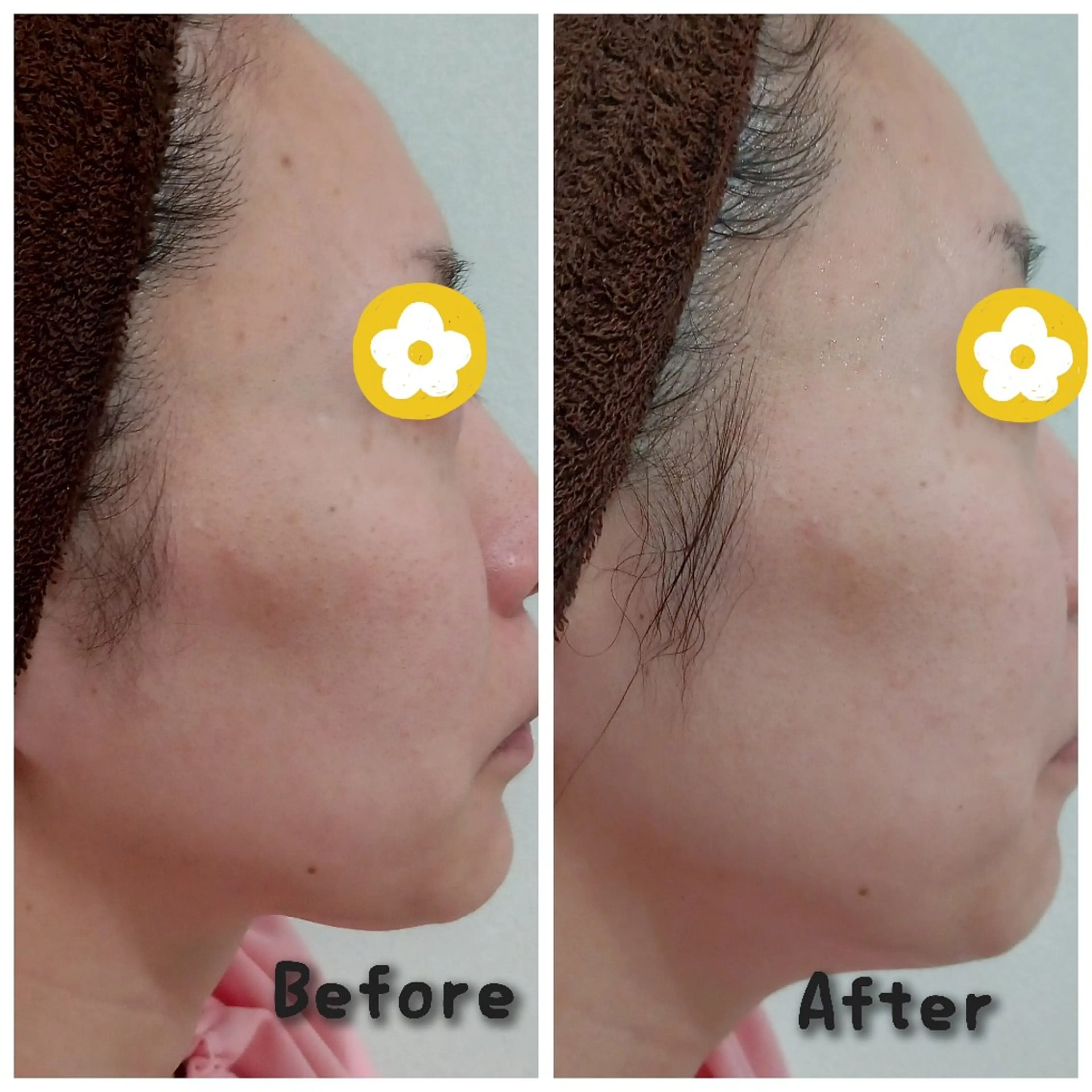 エステ エステティクサロン Moon-bellのエステ・リラクイメージ