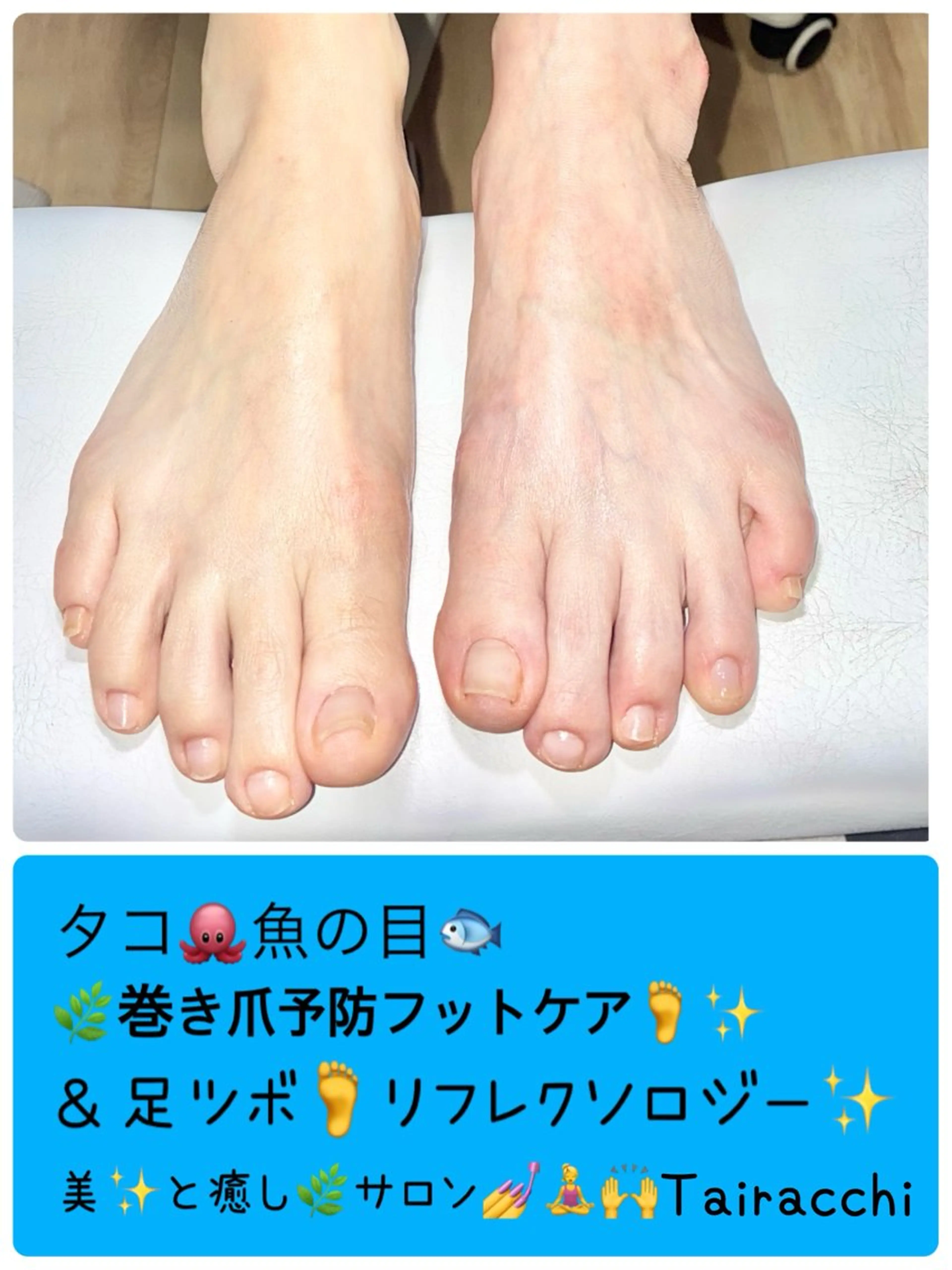 ネイル フットネイル フットネイル Tairacchi ﾀｲﾗｯﾁのエステ・リラクイメージ