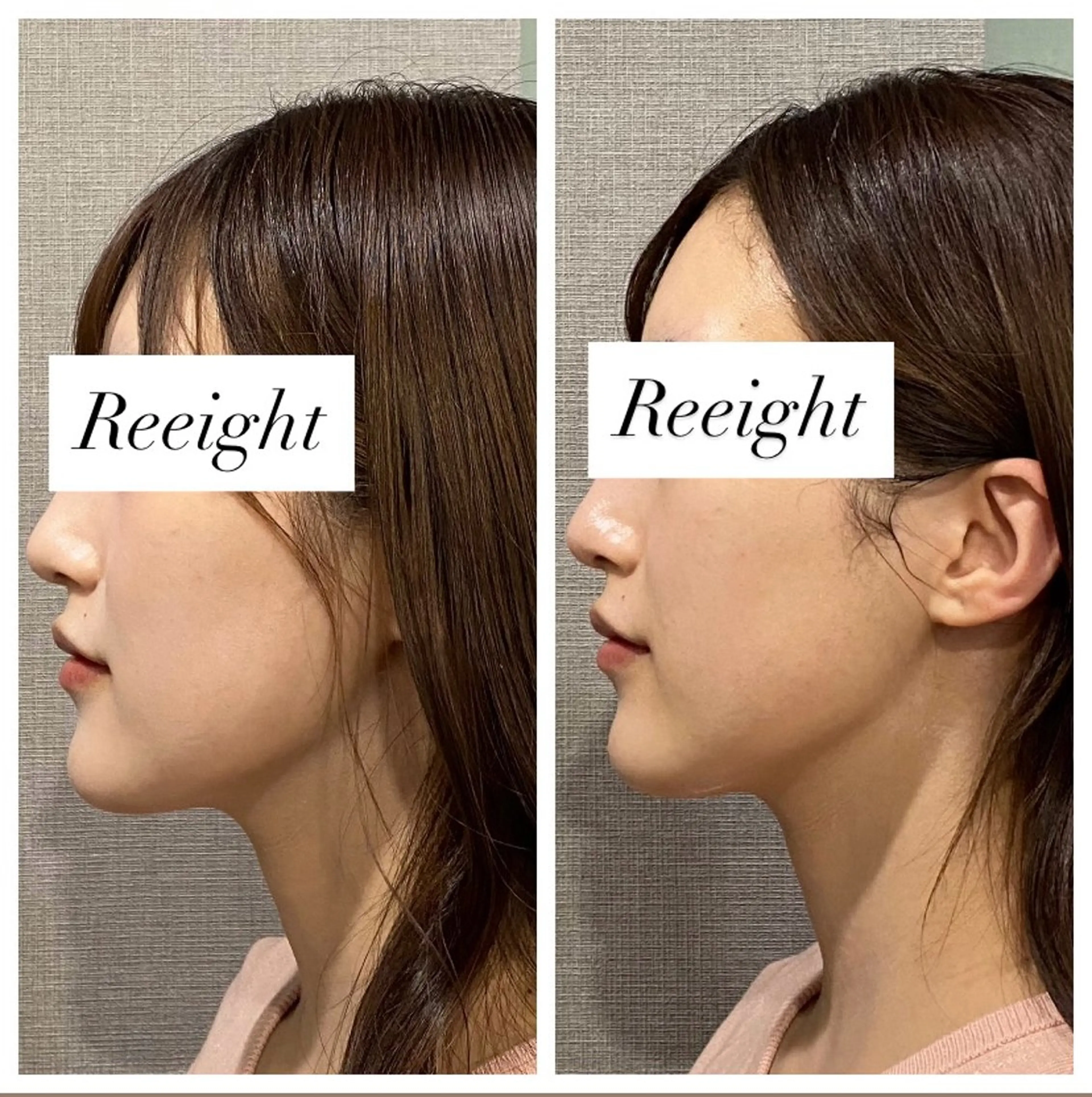 エステ 肌質改善専門 ハーブ /毛穴洗浄 リエイトのエステ・リラクイメージ