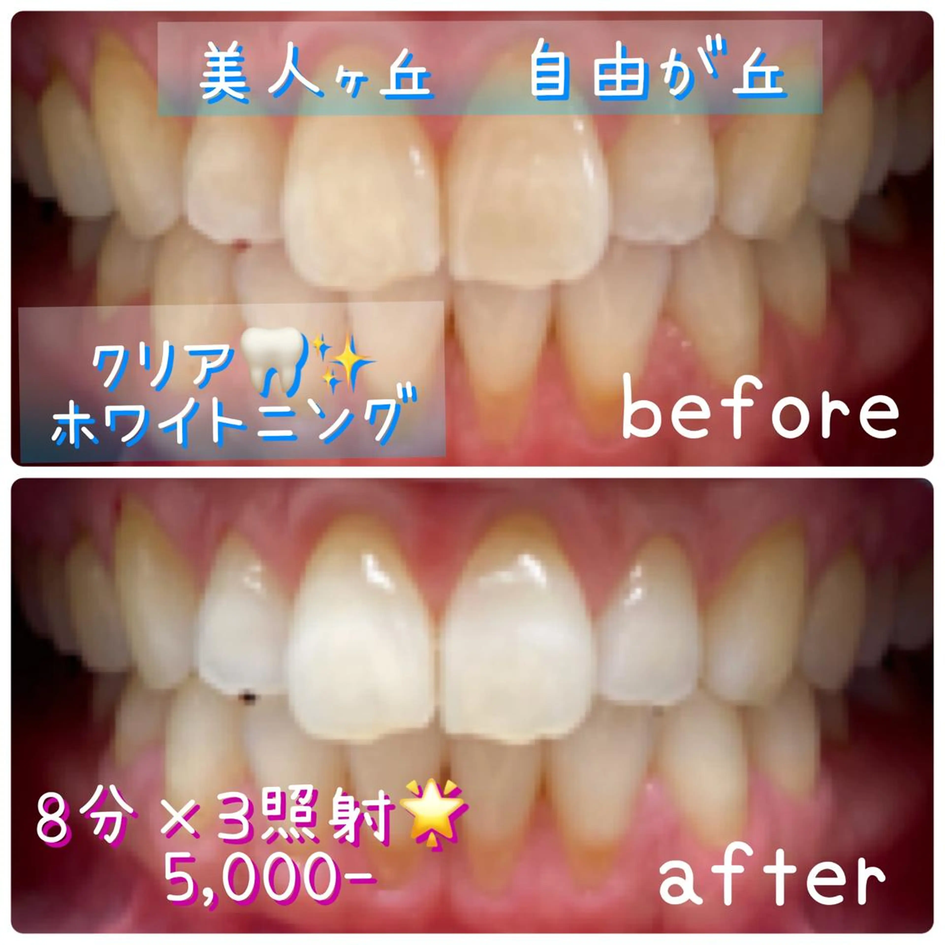 韓国/ヌーディー系 ネイル自由が丘のネイルデザイン