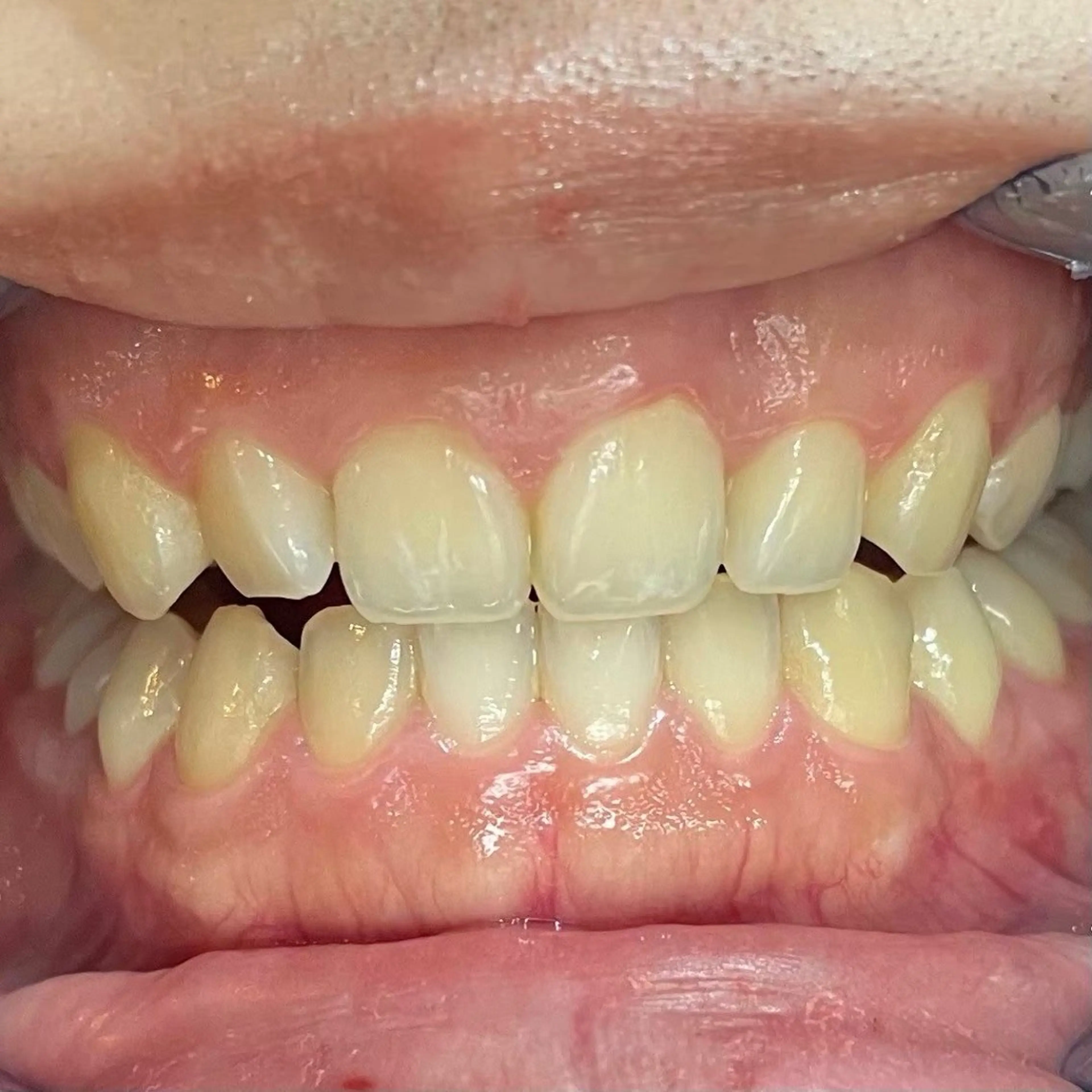 セルフホワイトニング サクホワ五反田店のその他イメージ