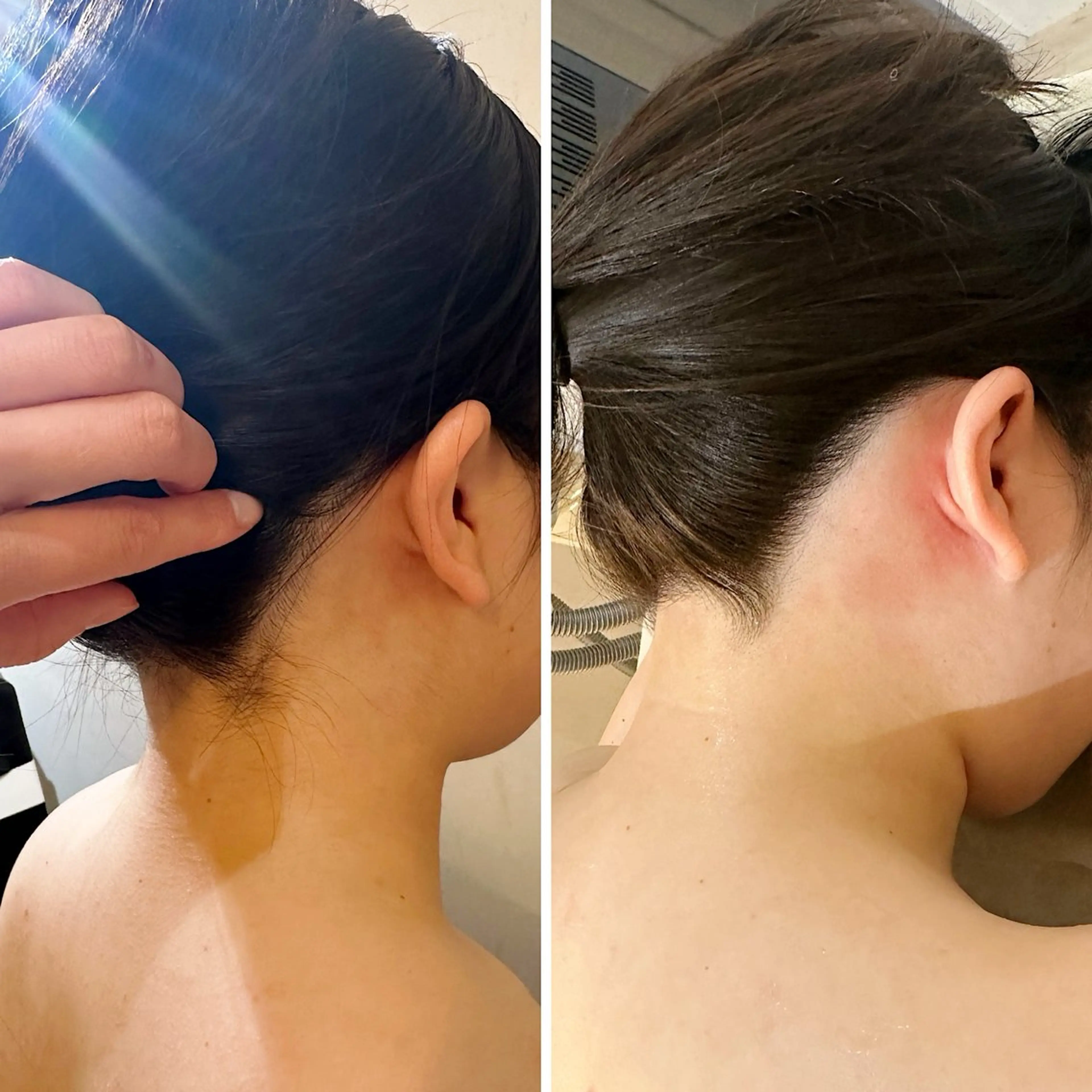 脱毛 うなじ脱毛/美肌脱毛 LABELのエステ・リラクイメージ