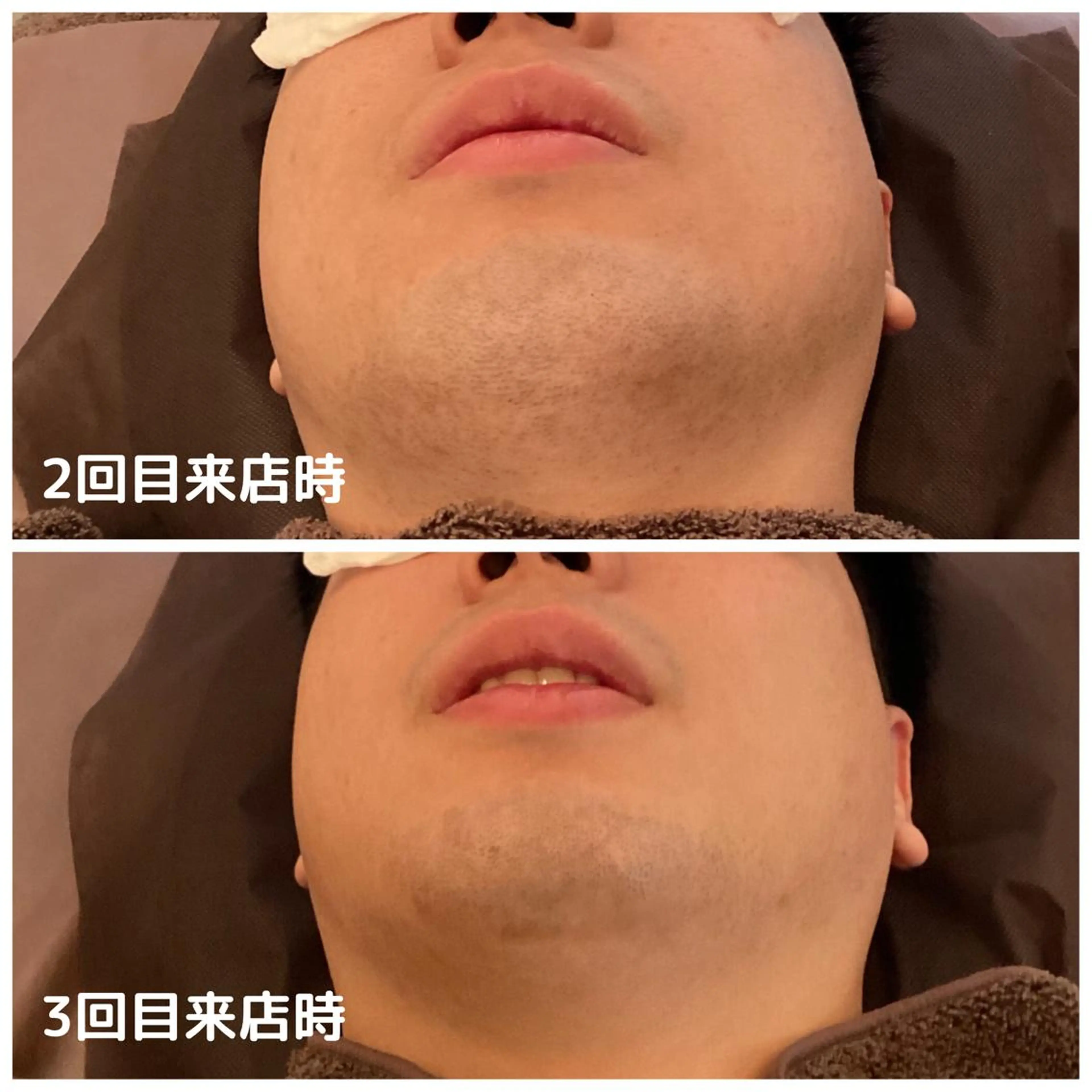 メンズ メンズ脱毛ECXIA所属・men's脱毛サロン ECXIAのエステ・リラクイメージ