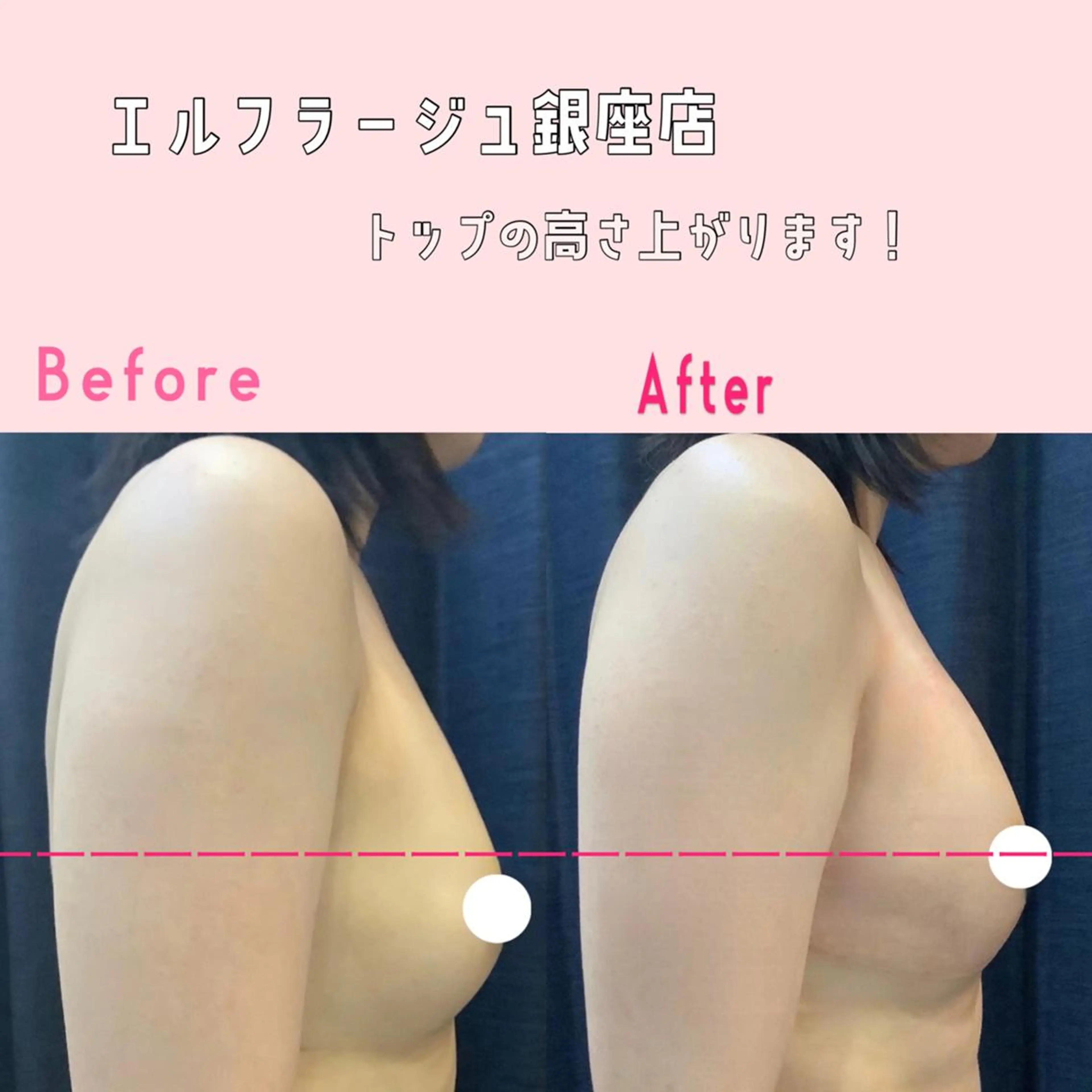 エステ リラク エルフラージュ 銀座店のエステ・リラクイメージ