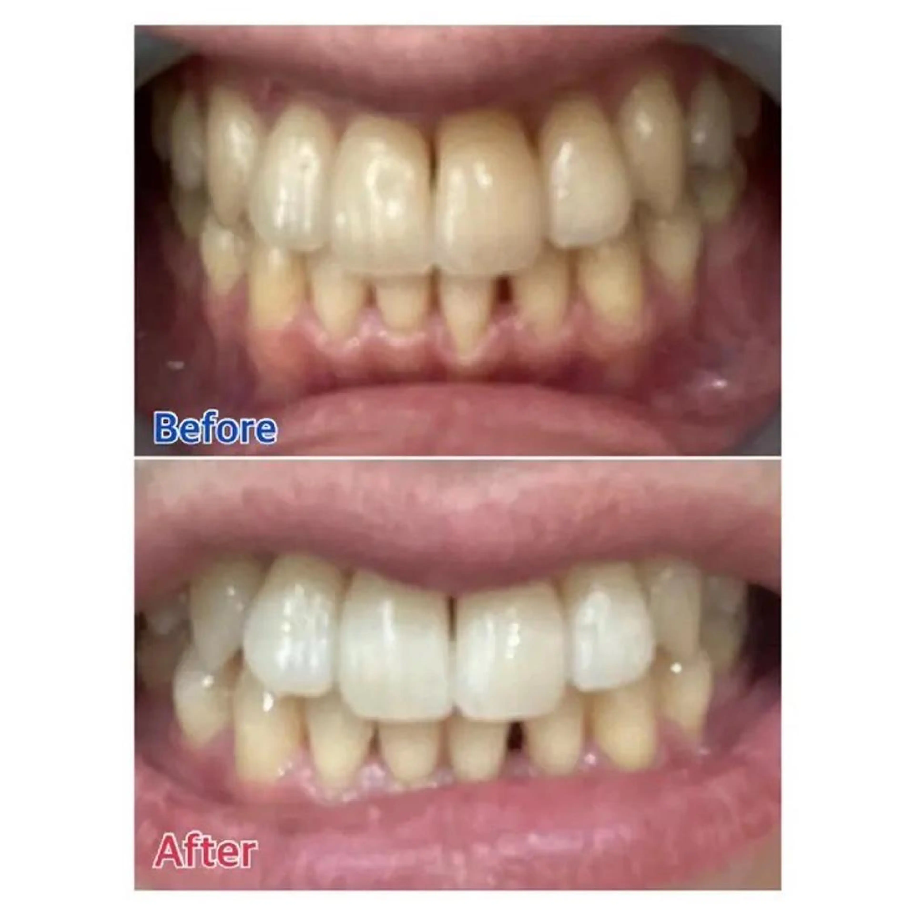 M渋谷 ホワイトニングのその他イメージ