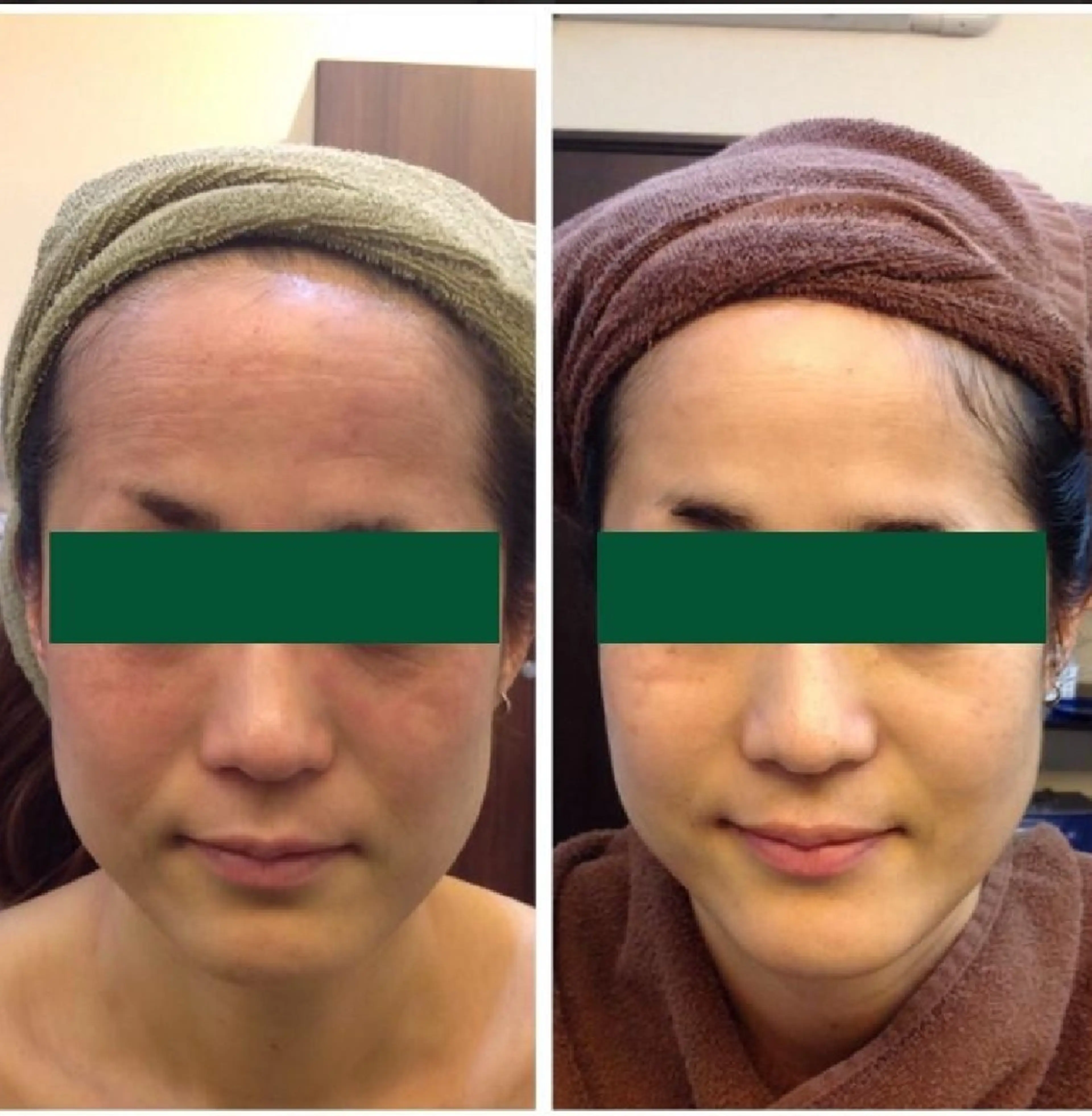 フットネイル LOUISE.所属・LOUISE. ／ネイルのネイルデザイン