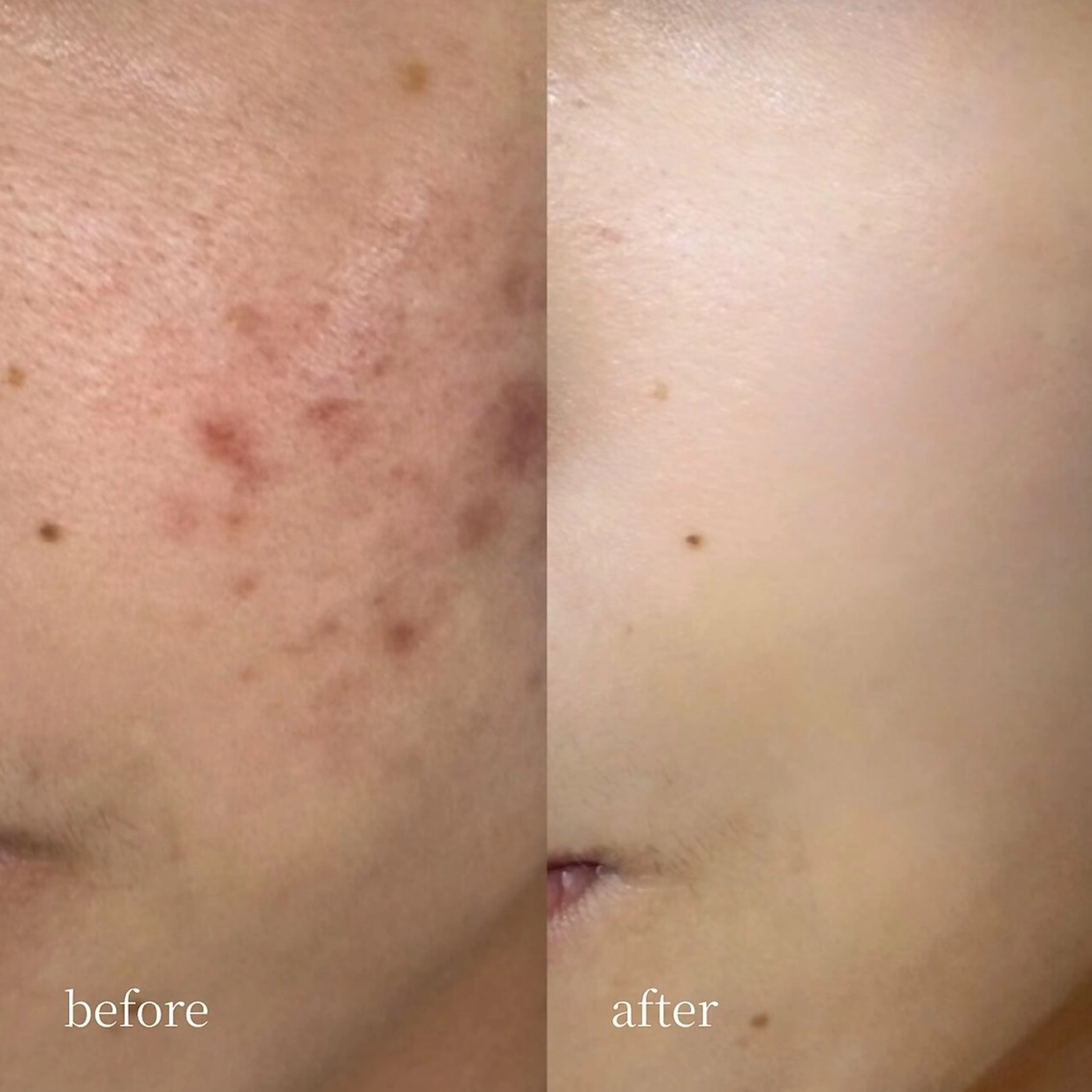 韓国肌管理・肌質改善 EARNEST心斎橋のエステ・リラクイメージ