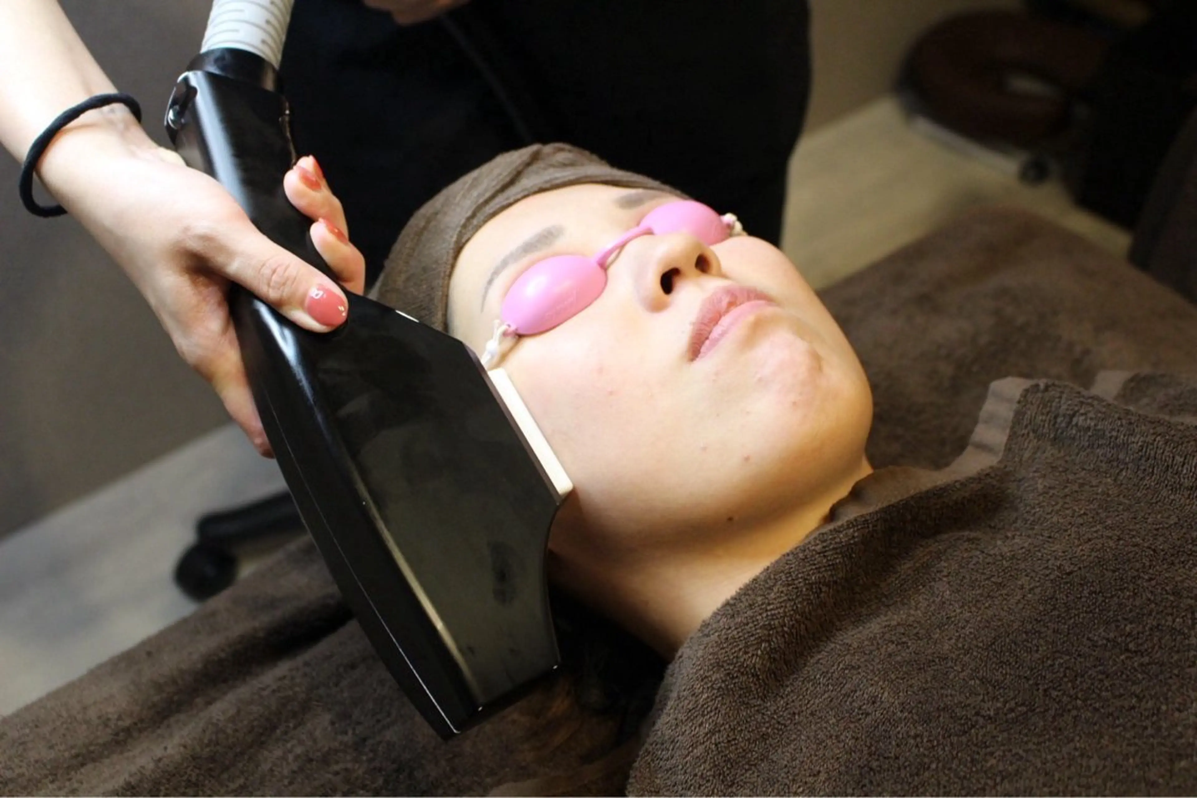 【レディース限定】脱・産毛！ワントーン明るい素肌へ。フェイシャル脱毛の写真