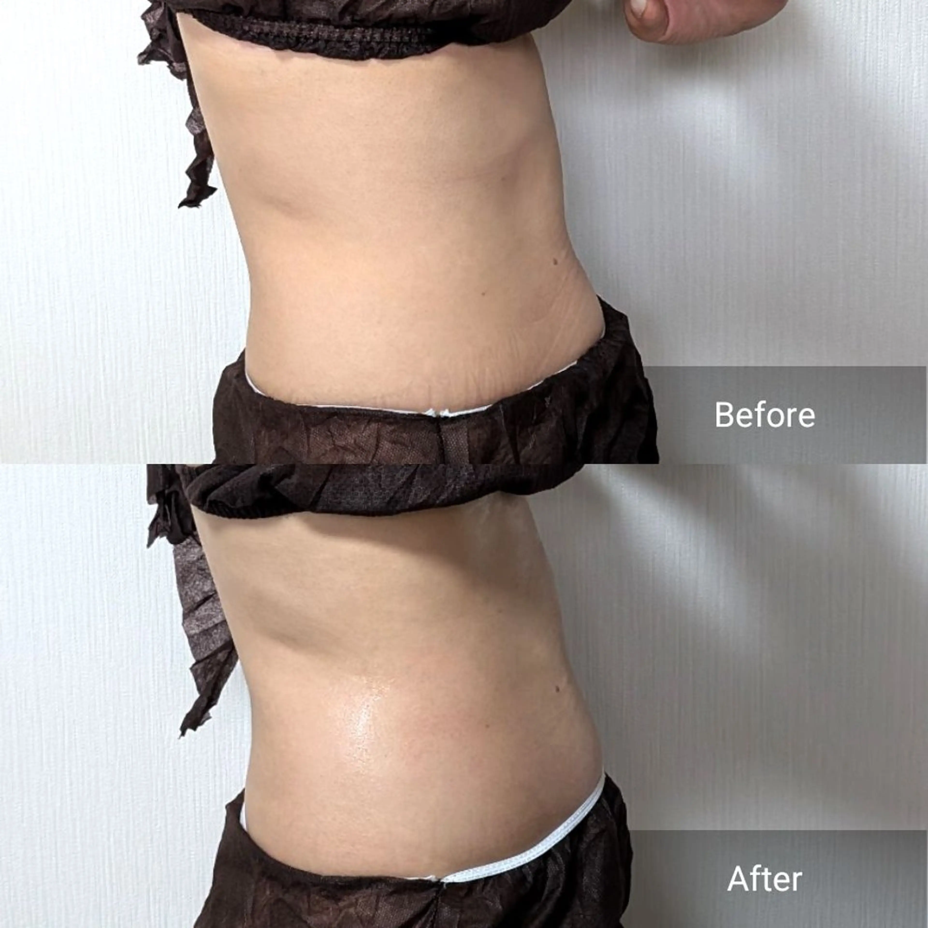 nail RiRi アトレナチュラのエステ・リラクイメージ