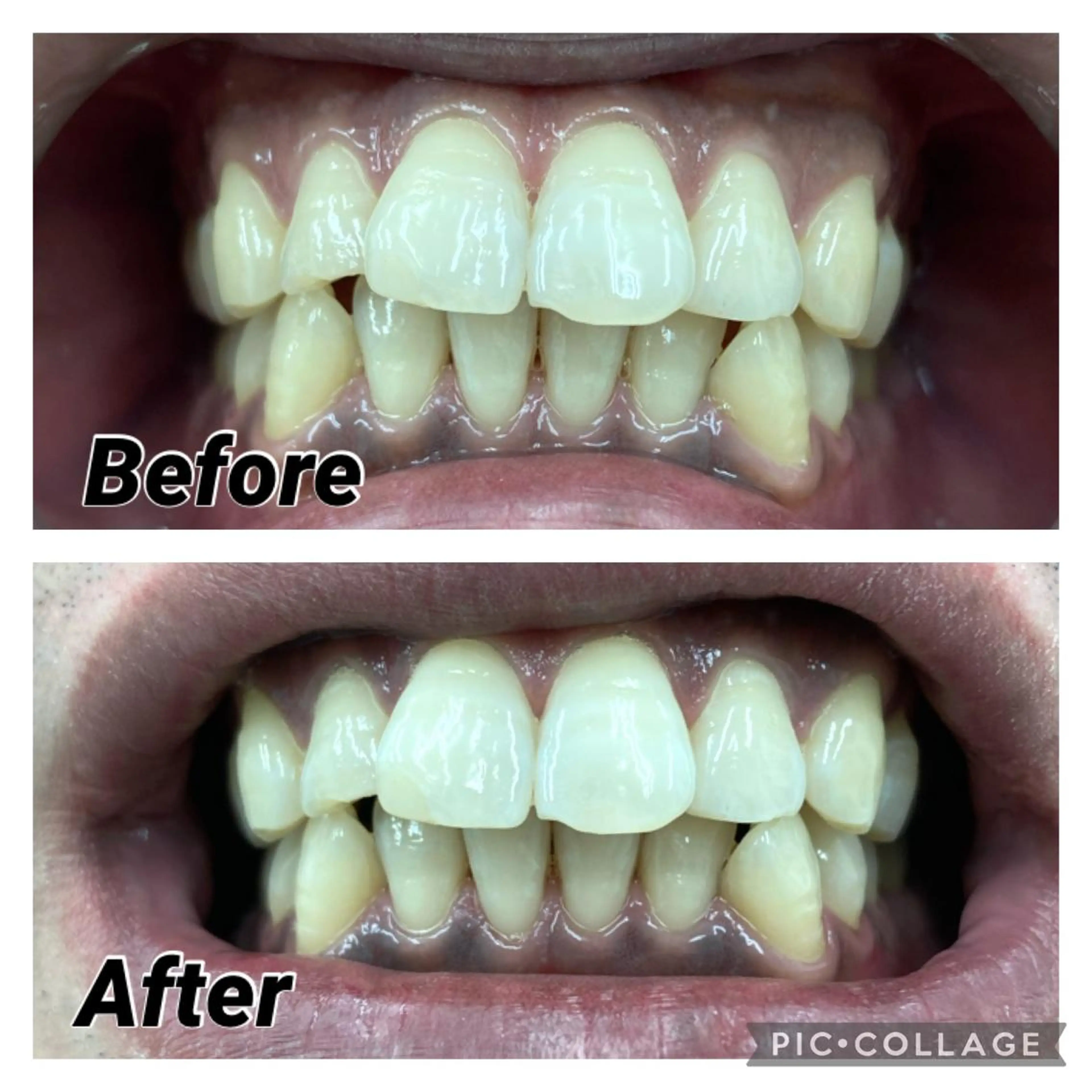 セルフホワイトニング COCOSHIROのエステ・リラクイメージ