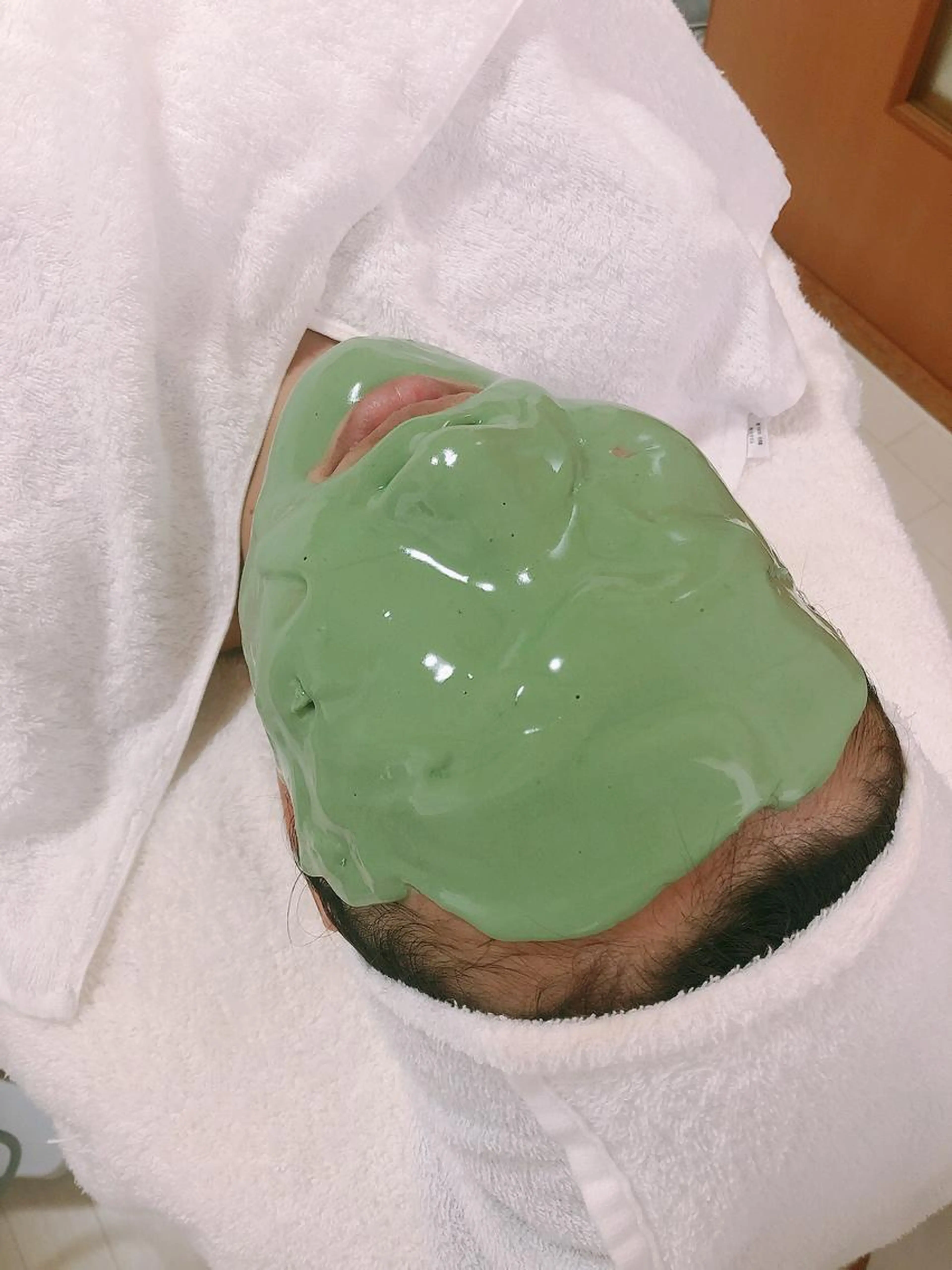 [🌹ニキビ✬マスクでの肌荒れに🌹]ｱﾄﾞﾊﾞﾝｽｺｰｽ＋薬用ビューネパック¥10450→初回¥4950✨の写真