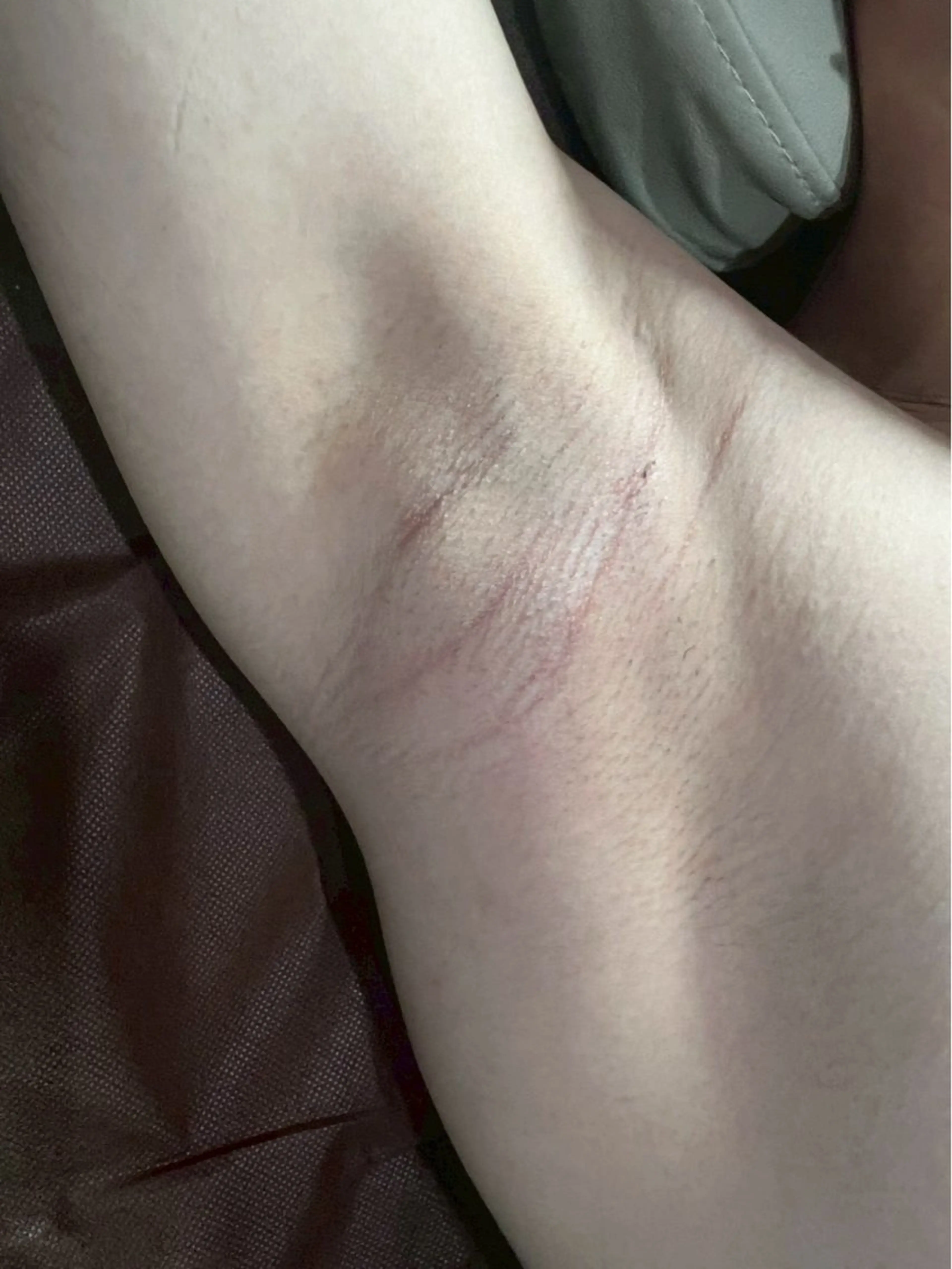 【初回限定】レディース・メンズ👩🏻👦🏻　　　　　　　　　　　ワキ脱毛の写真