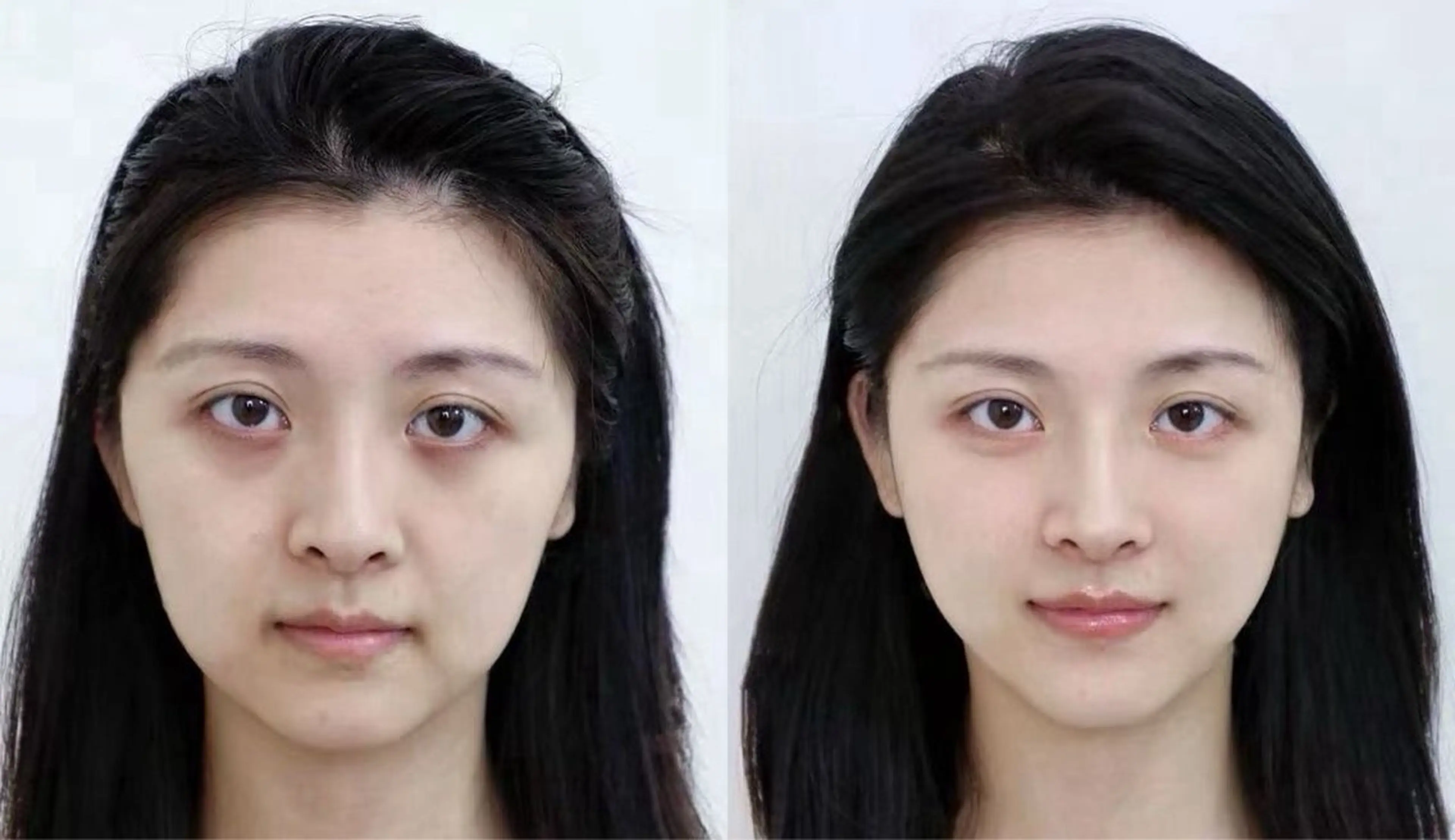 マツエク・マツパ aliaハーブ水光店 エステティシャン募集のエステ・リラクイメージ