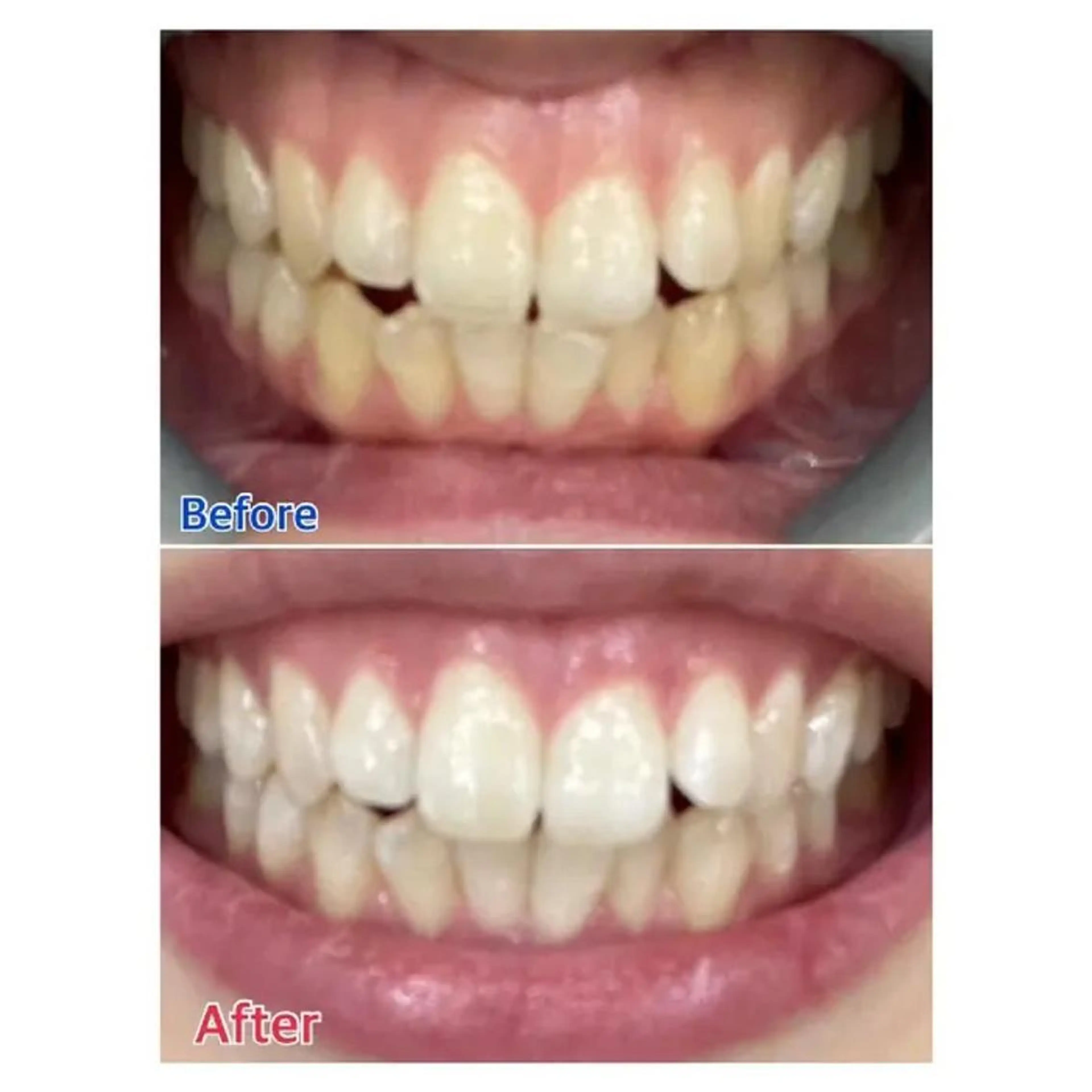 M渋谷 ホワイトニングのその他イメージ