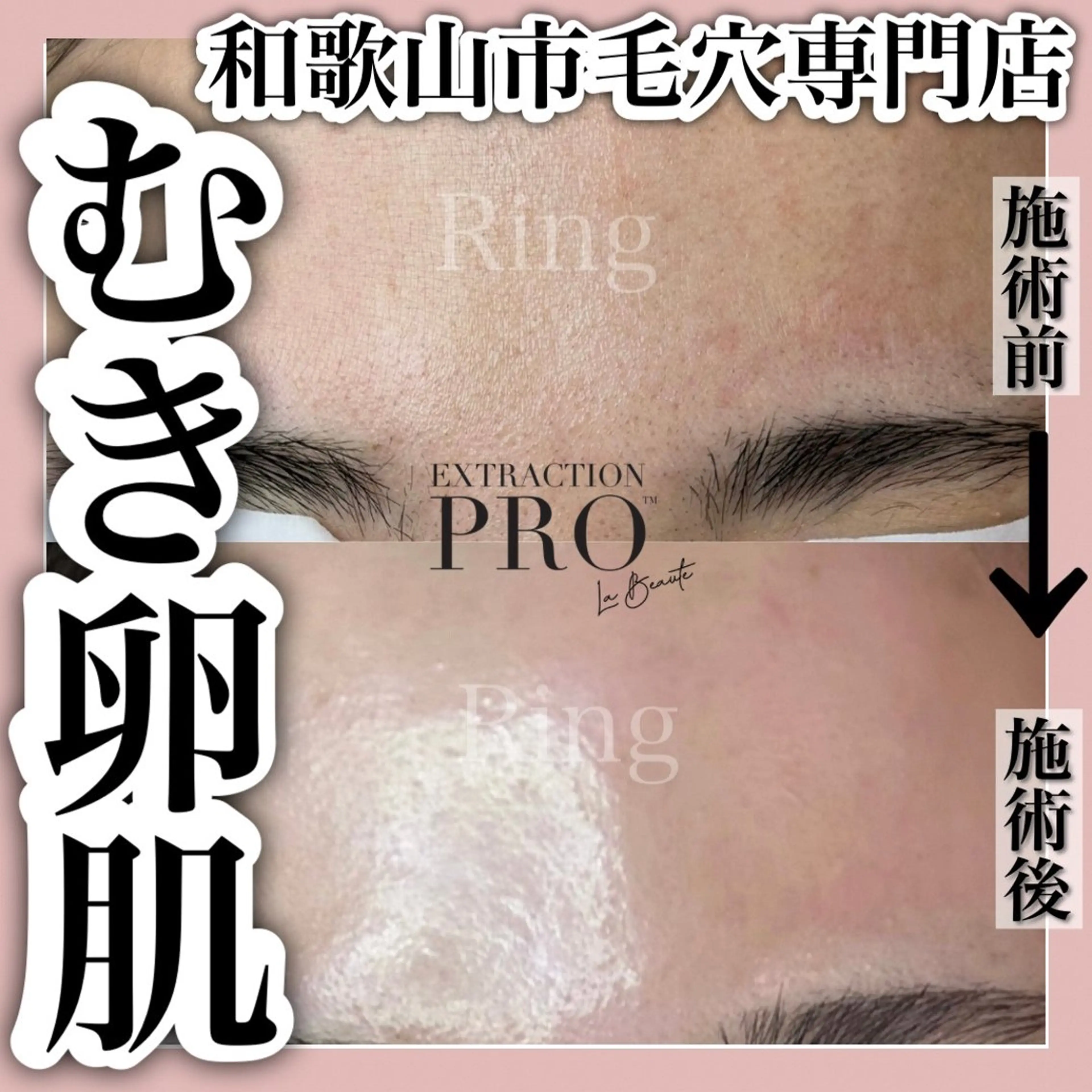 和歌山　毛穴専門店 Ringのエステ・リラクイメージ