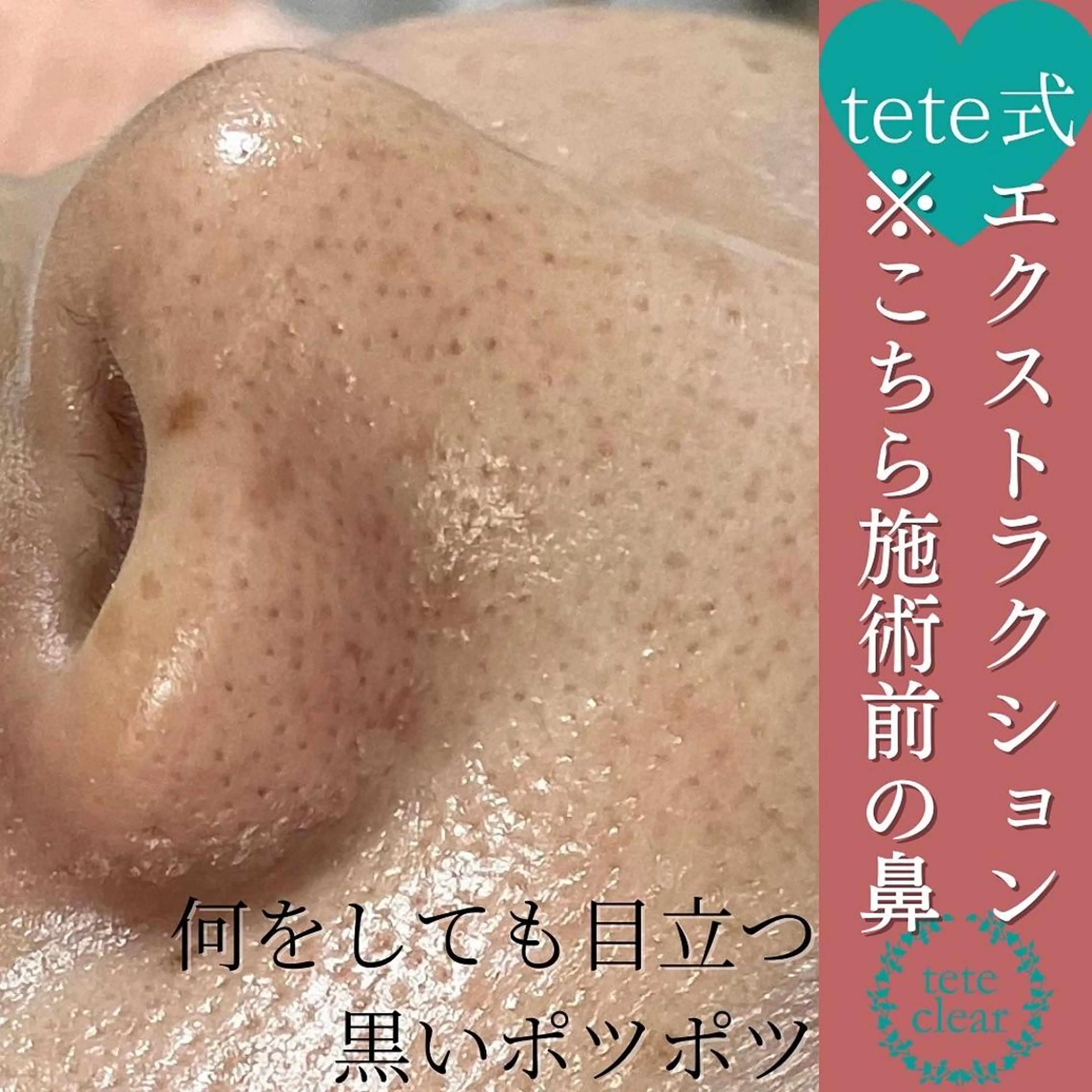 毛穴肌質ケアサロン Yourmeユアミーのエステ・リラクイメージ