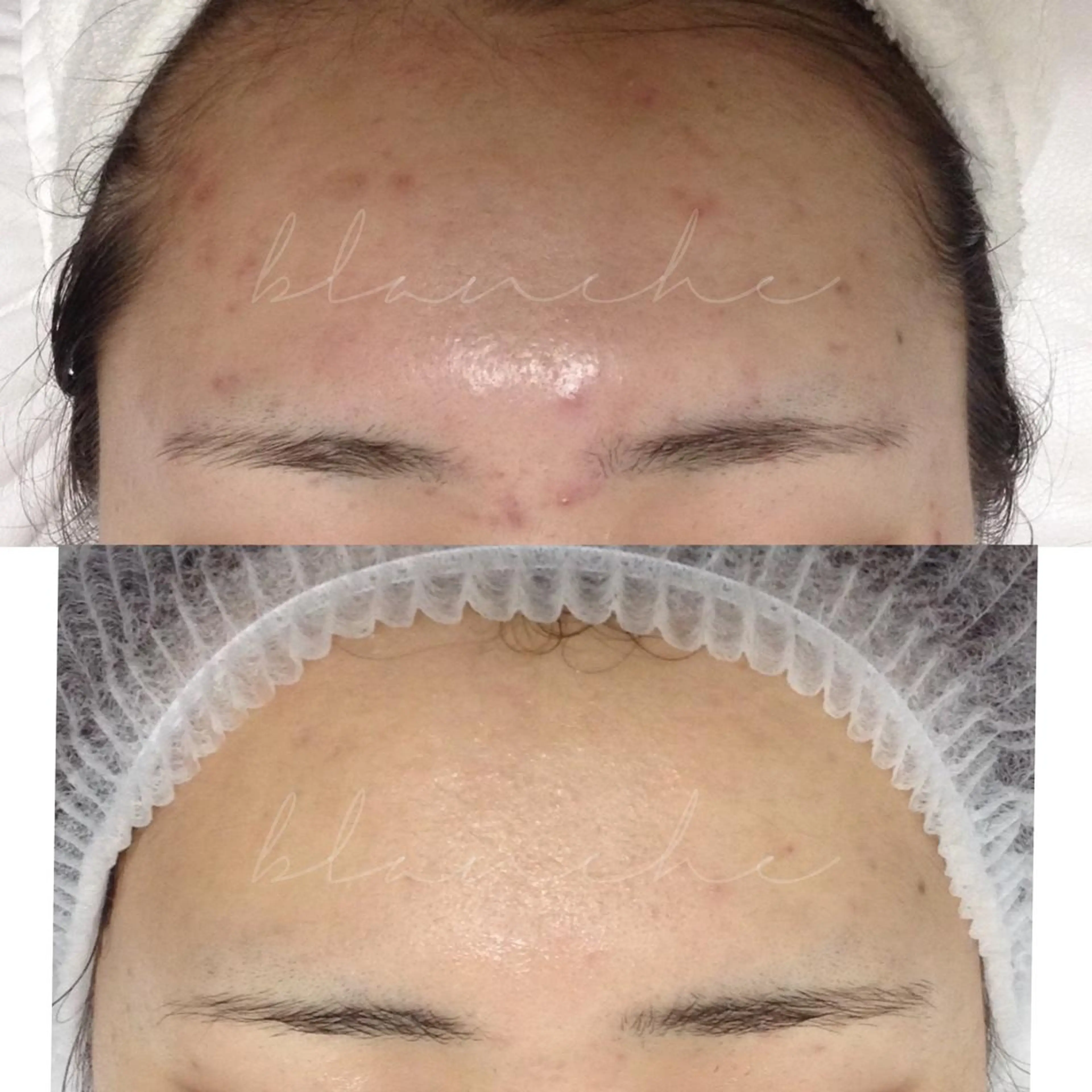 セミロング カラー パーマ ヘアアレンジ ネイル マツエク・マツパ アイブロウ エステ リラク 都度払い肌質改善 &脱毛Blancheのエステ・リラクイメージ