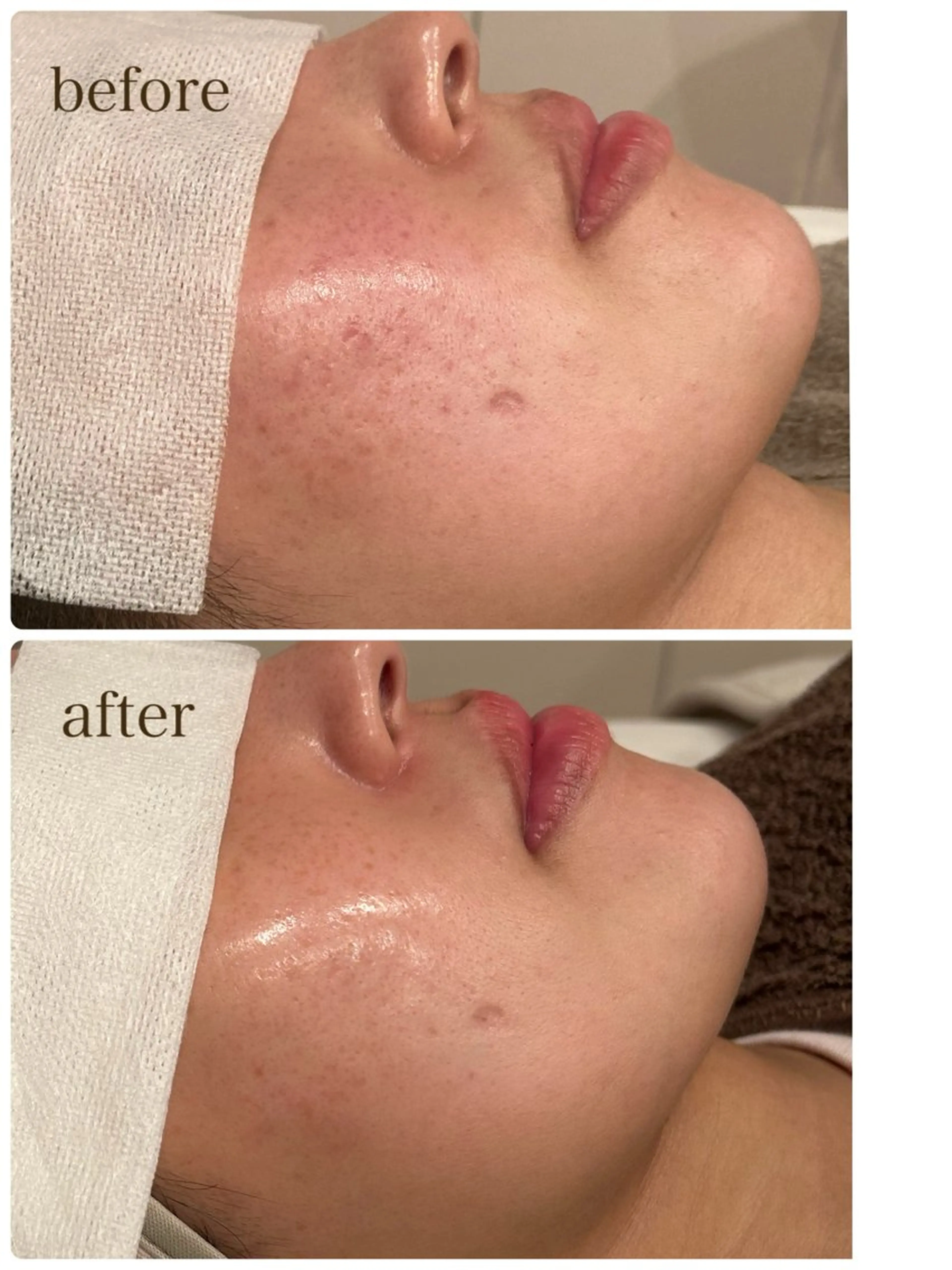 エステ リラク 小顔×肌質改善サロン soin〔ソワン〕のエステ・リラクイメージ