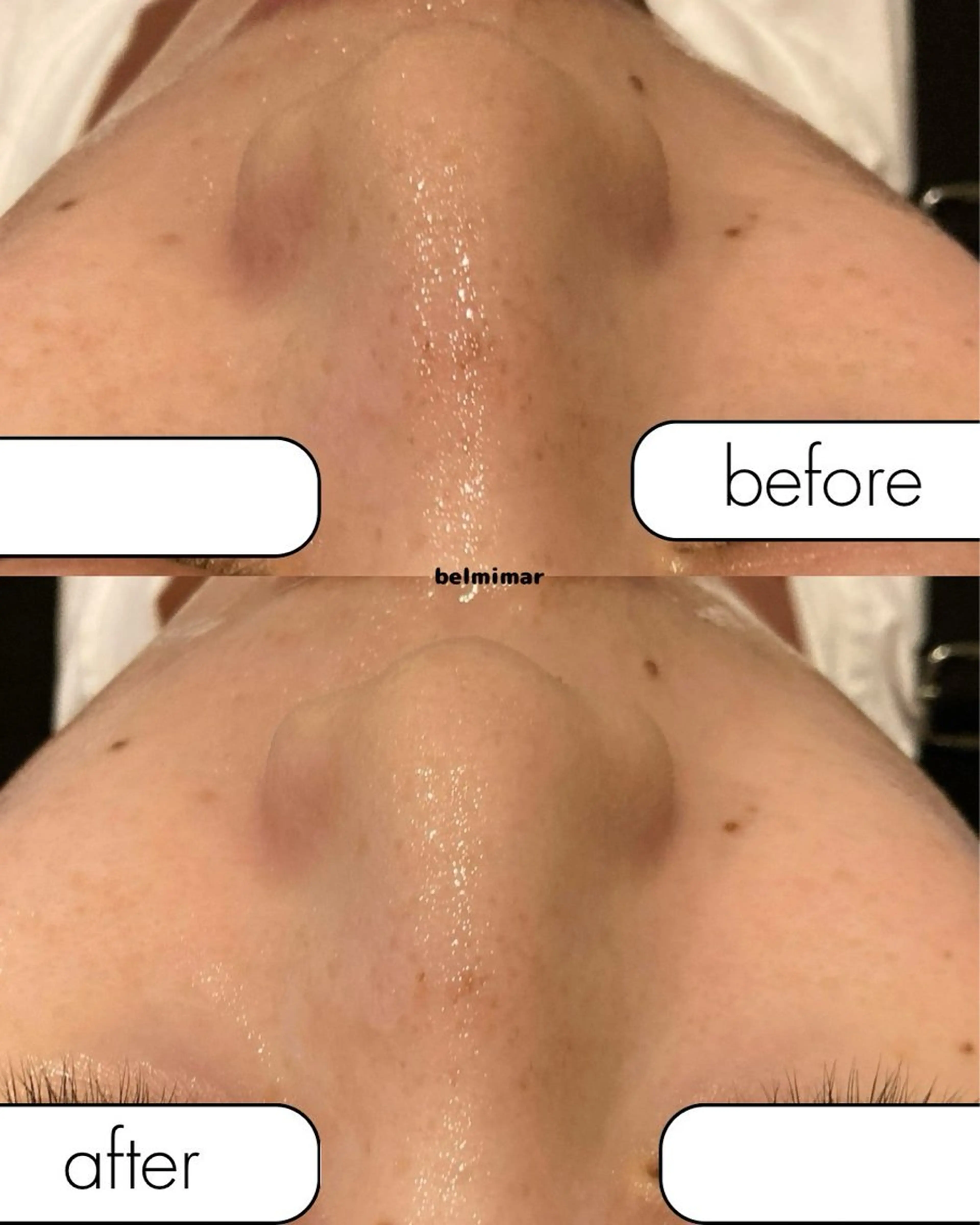 南森町・肌質改善 BELMIMARのエステ・リラクイメージ