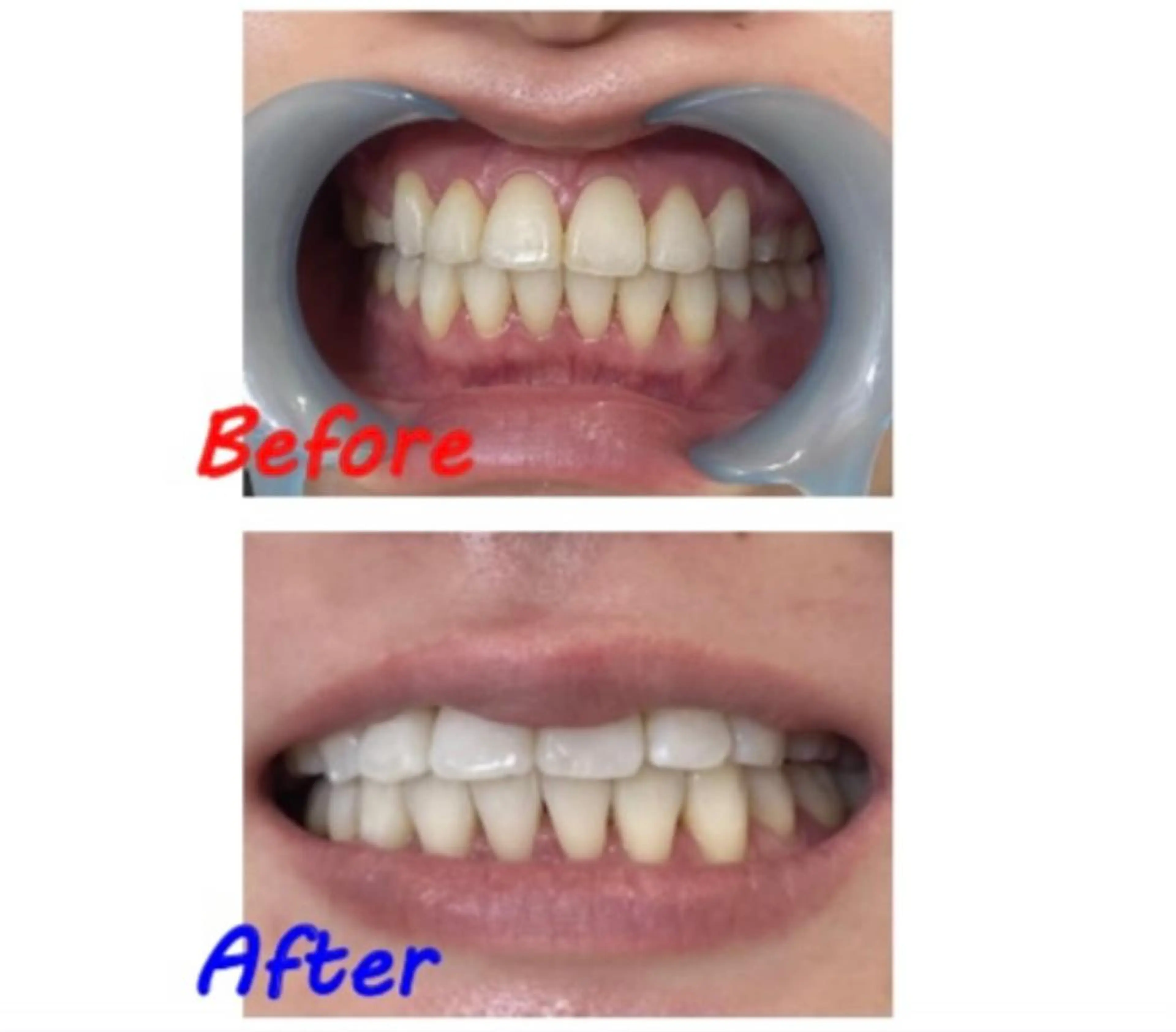 その他 セルフホワイトニングサロン　ラヴィアン所属・ホワイトニングサロン La vie enのその他イメージ