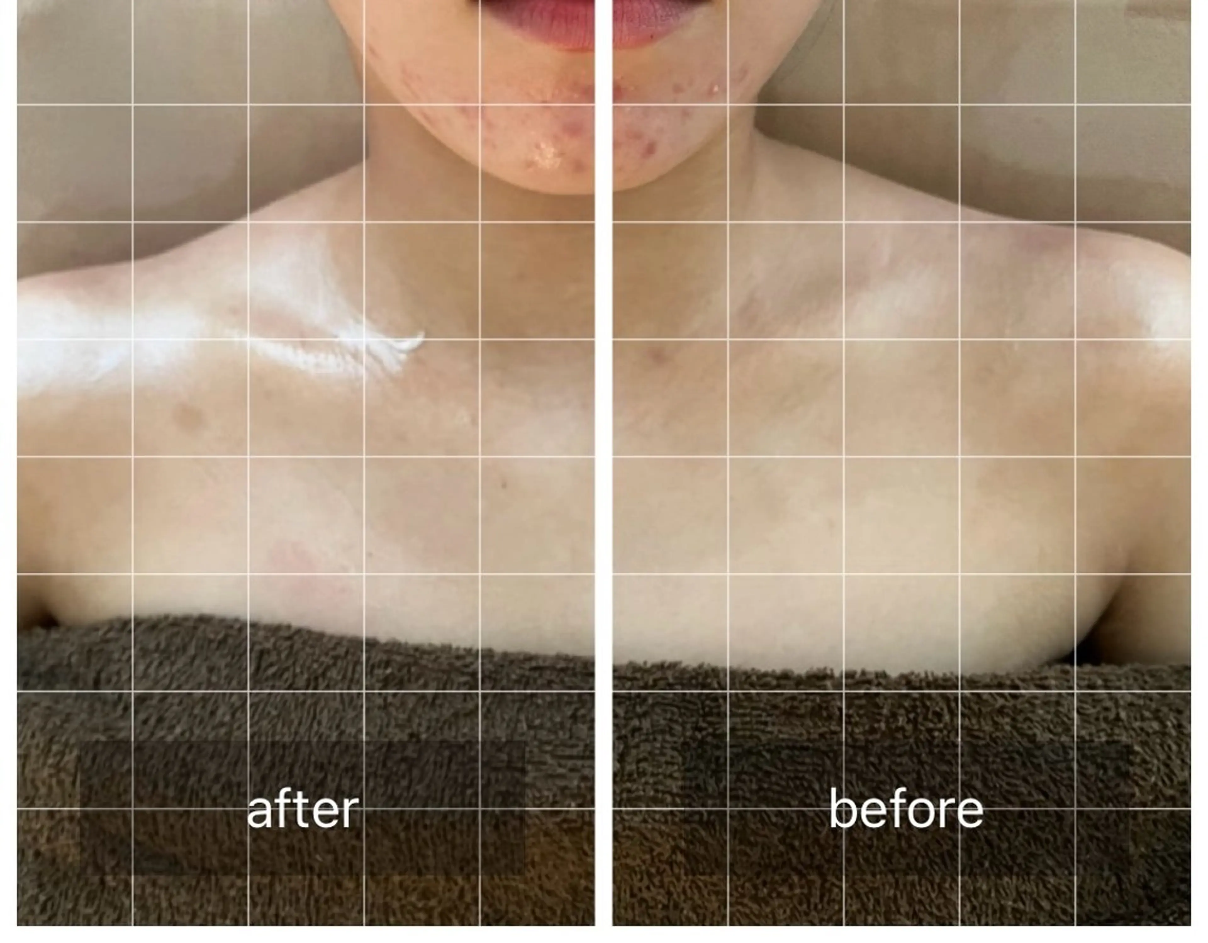 心斎橋痩身ダイエット 韓国.美容鍼.小顔のエステ・リラクイメージ