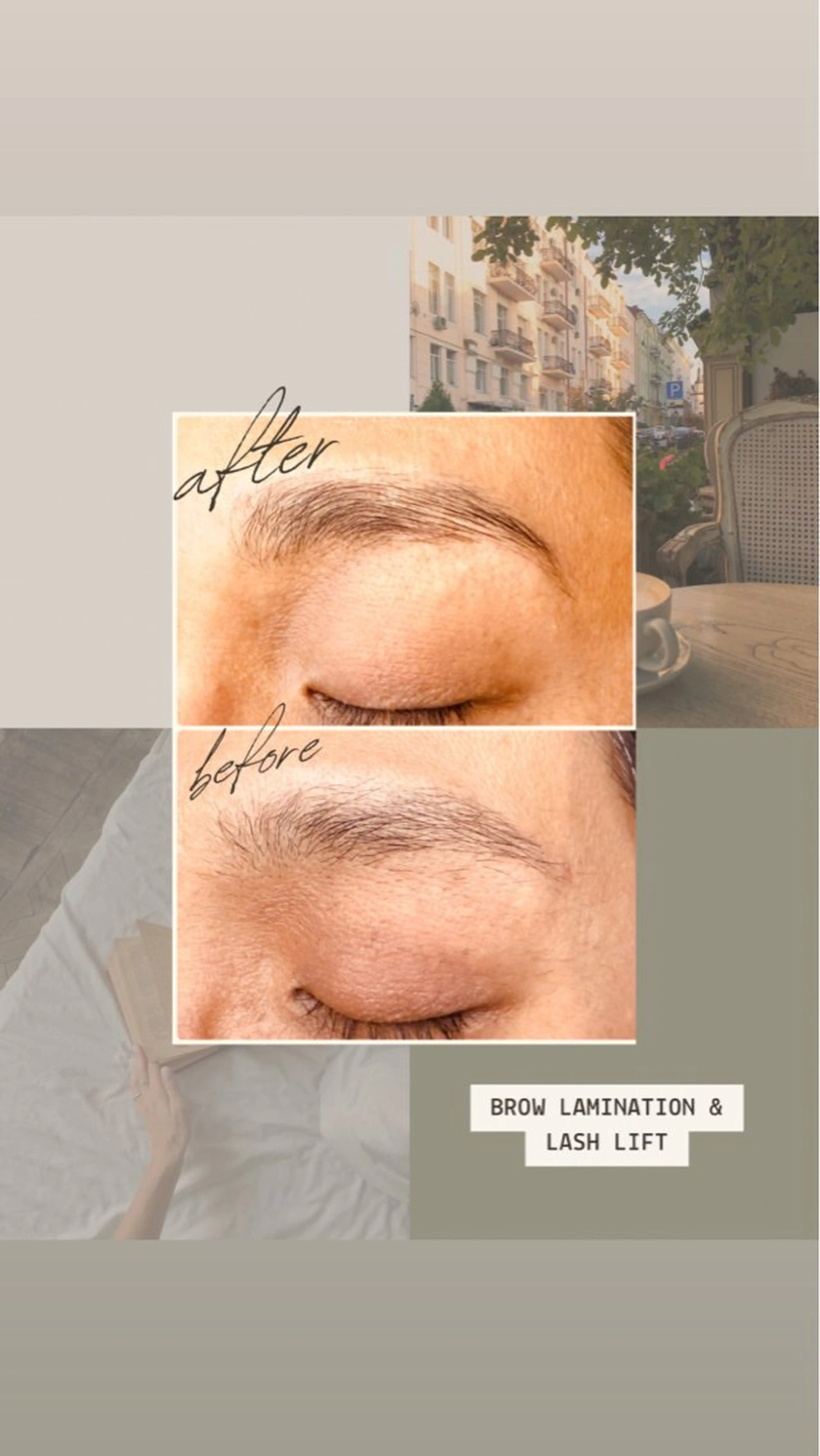 お口周り光脱毛+アイブロウリフトwax込𐙚 ˚の写真