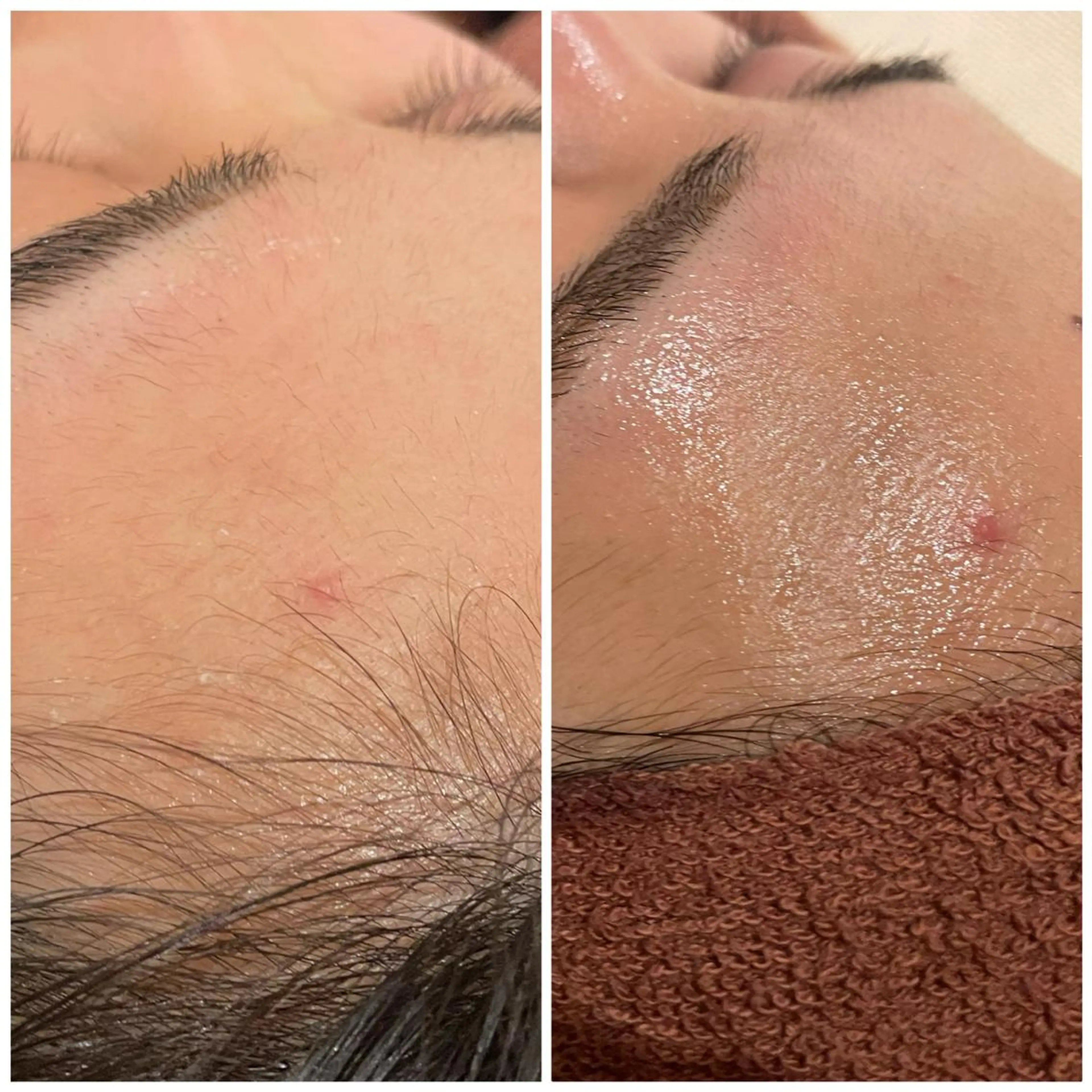 セミロング カラー パーマ ヘアアレンジ メンズ キッズ ネイル マツエク・マツパ アイブロウ エステ リラク ニキビ特化型エステ 🍋最短で肌質改善のエステ・リラクイメージ