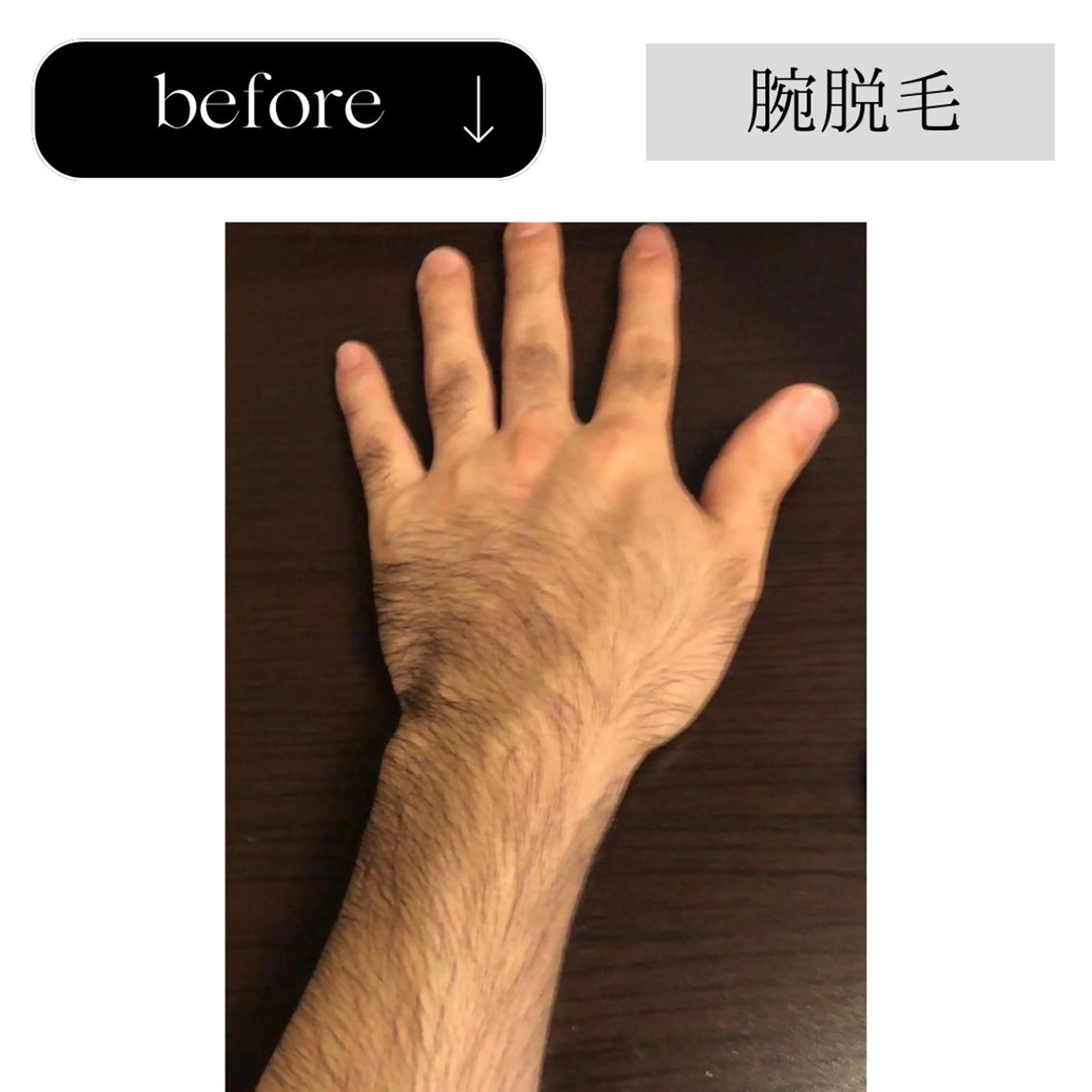 脱毛 beauty CHOOSEのエステ・リラクイメージ