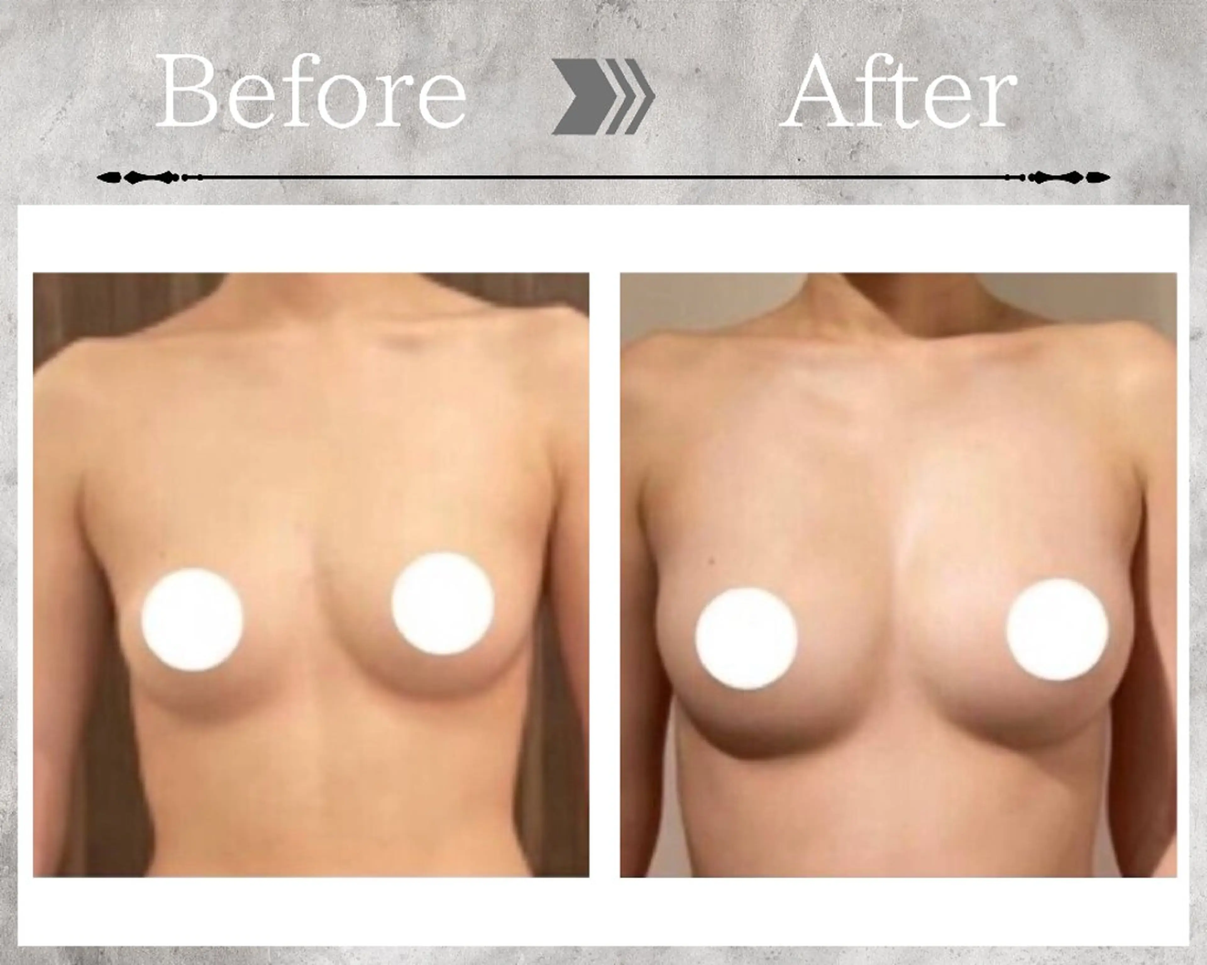 その他 Feliz(ユーカリレンタルサロン内)所属・【バストケアサロン】 Feliz フェリスのエステ・リラクイメージ