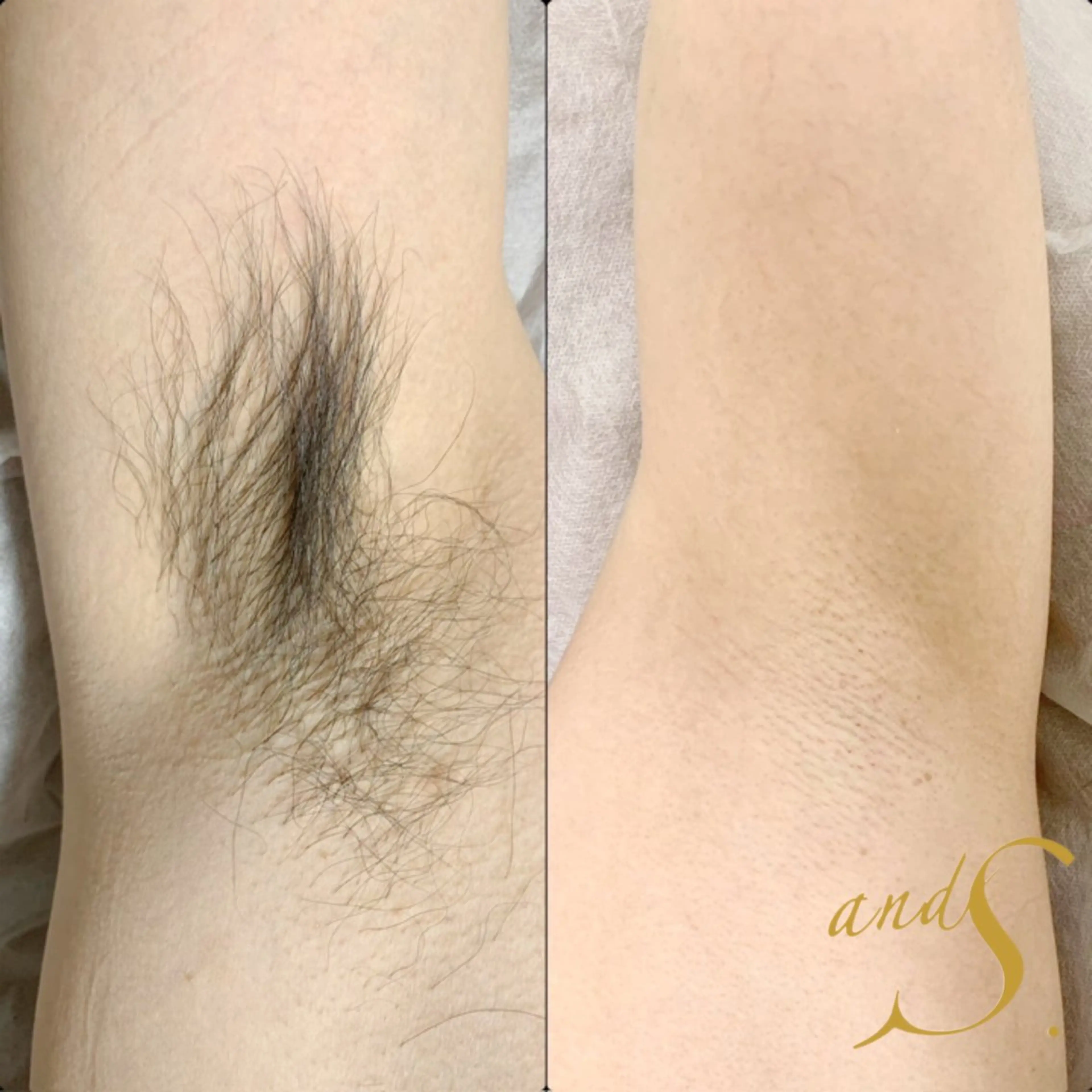 脱毛 🌸🧡六本木 脱毛しずか🧡🫧の眉毛・アイブロウイメージ