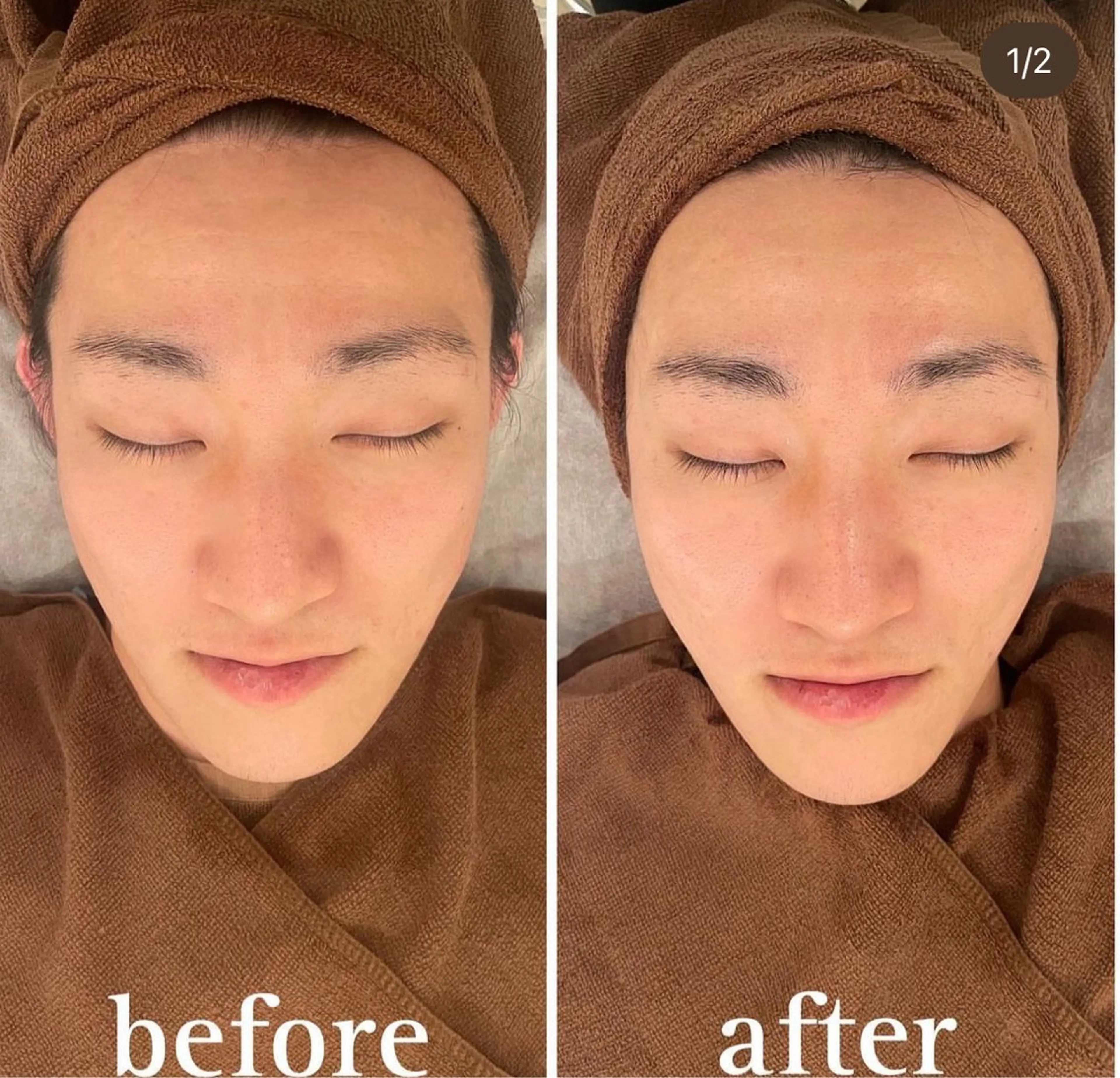 小顔・リフトアップ/ 奈緒美のエステ・リラクイメージ