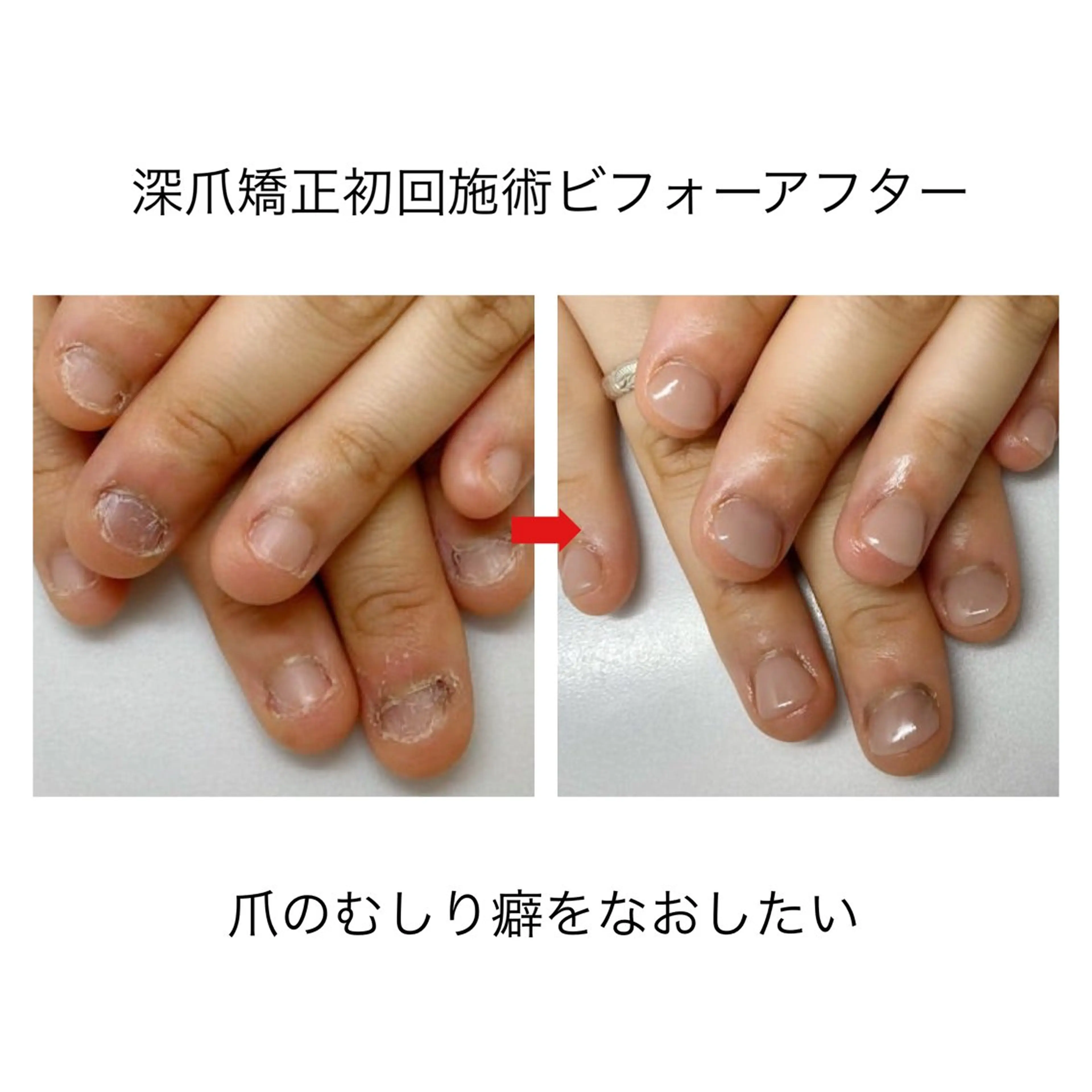 ネイル ネイルサロン アリュームのネイルデザイン