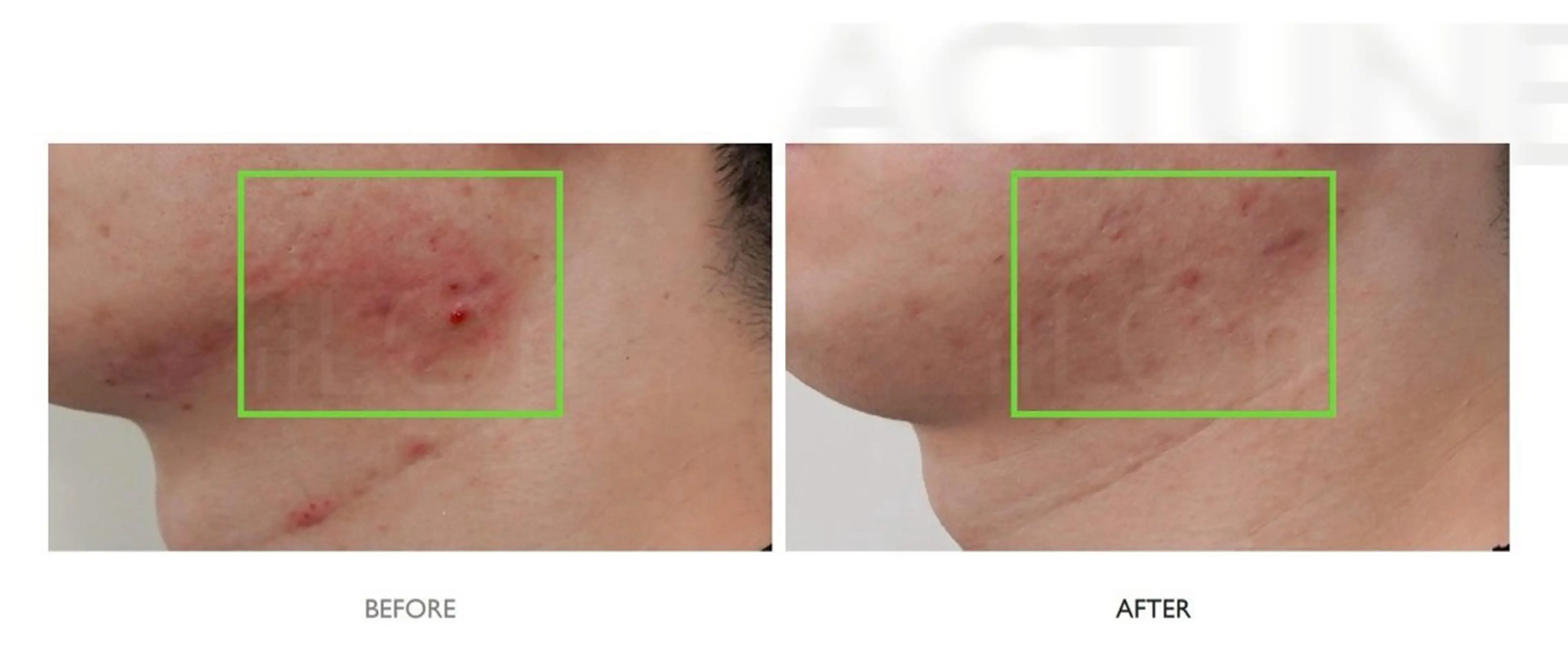 🎀韓国肌管理🎀 Mikiのエステ・リラクイメージ